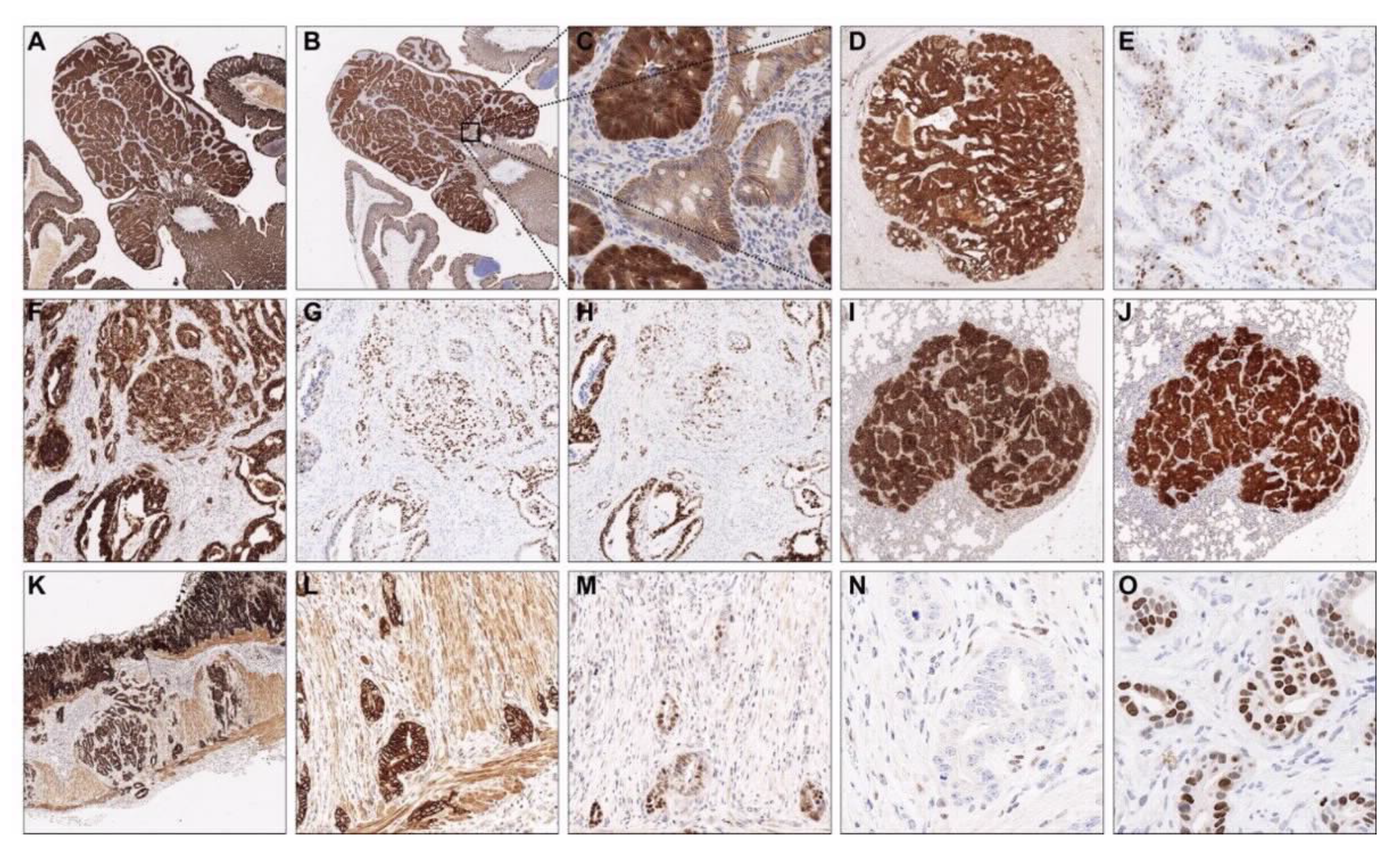 Cancers 13 00808 g003