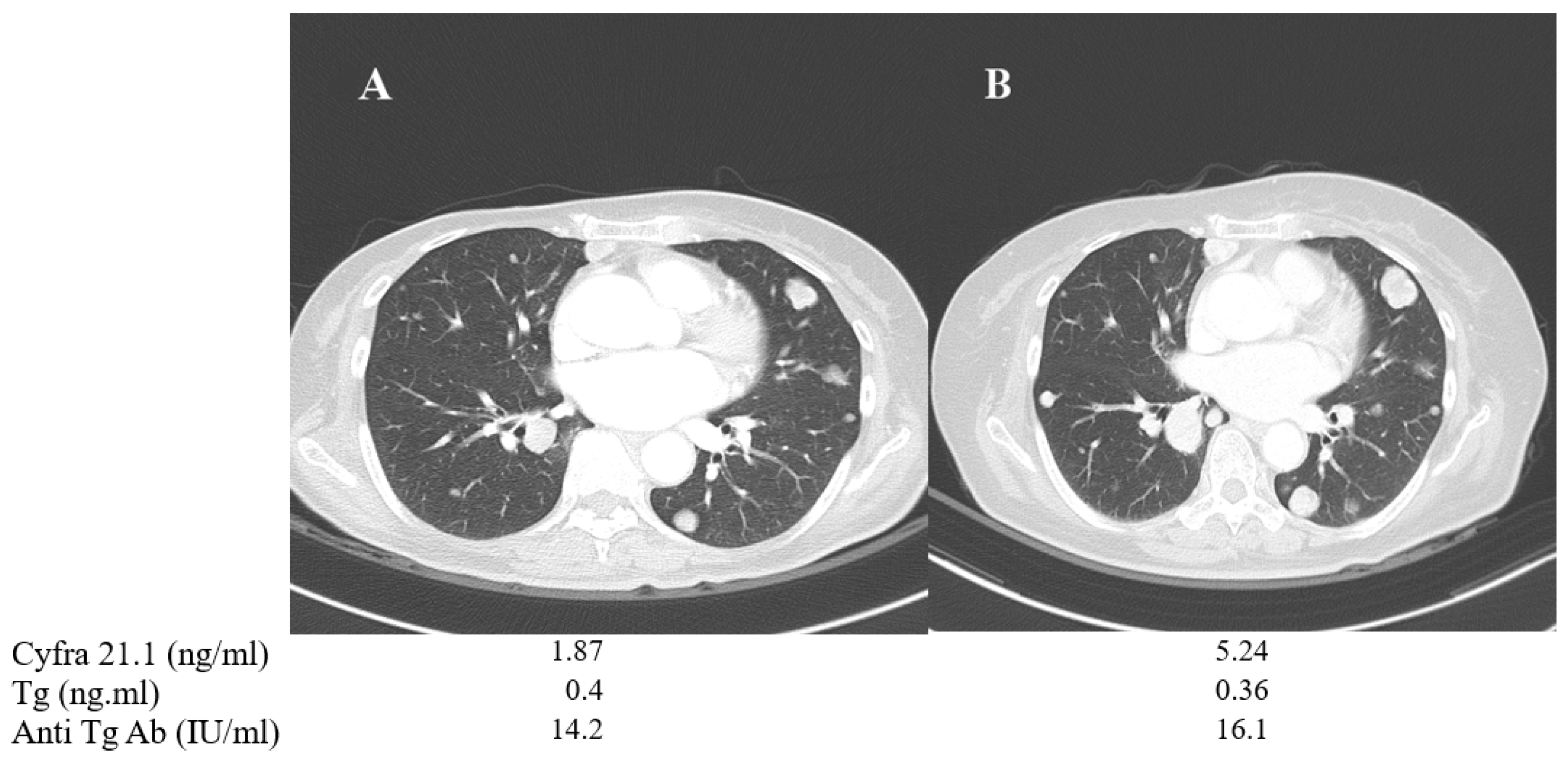Cancers 13 00811 g004