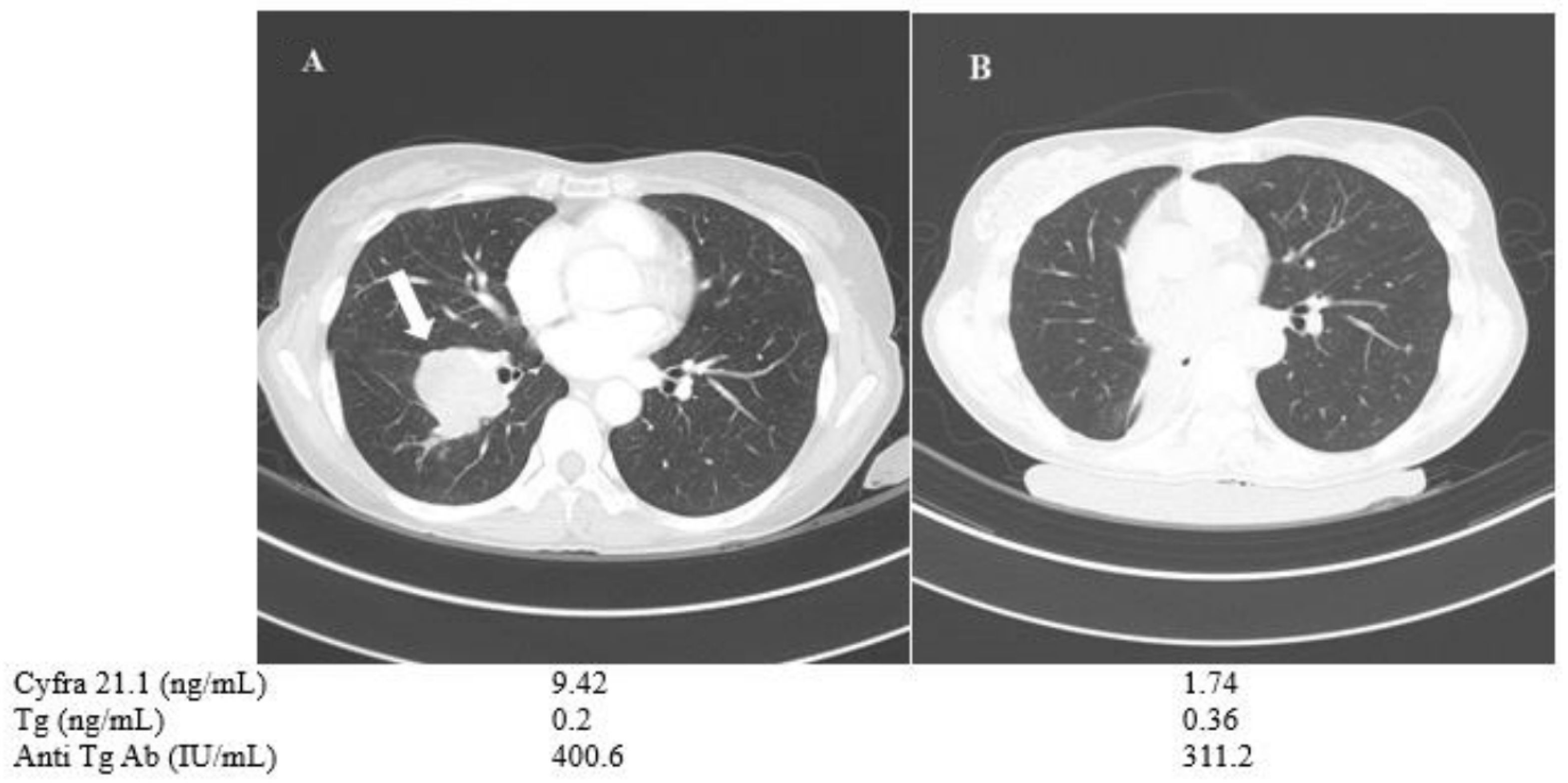 Cancers 13 00811 g005