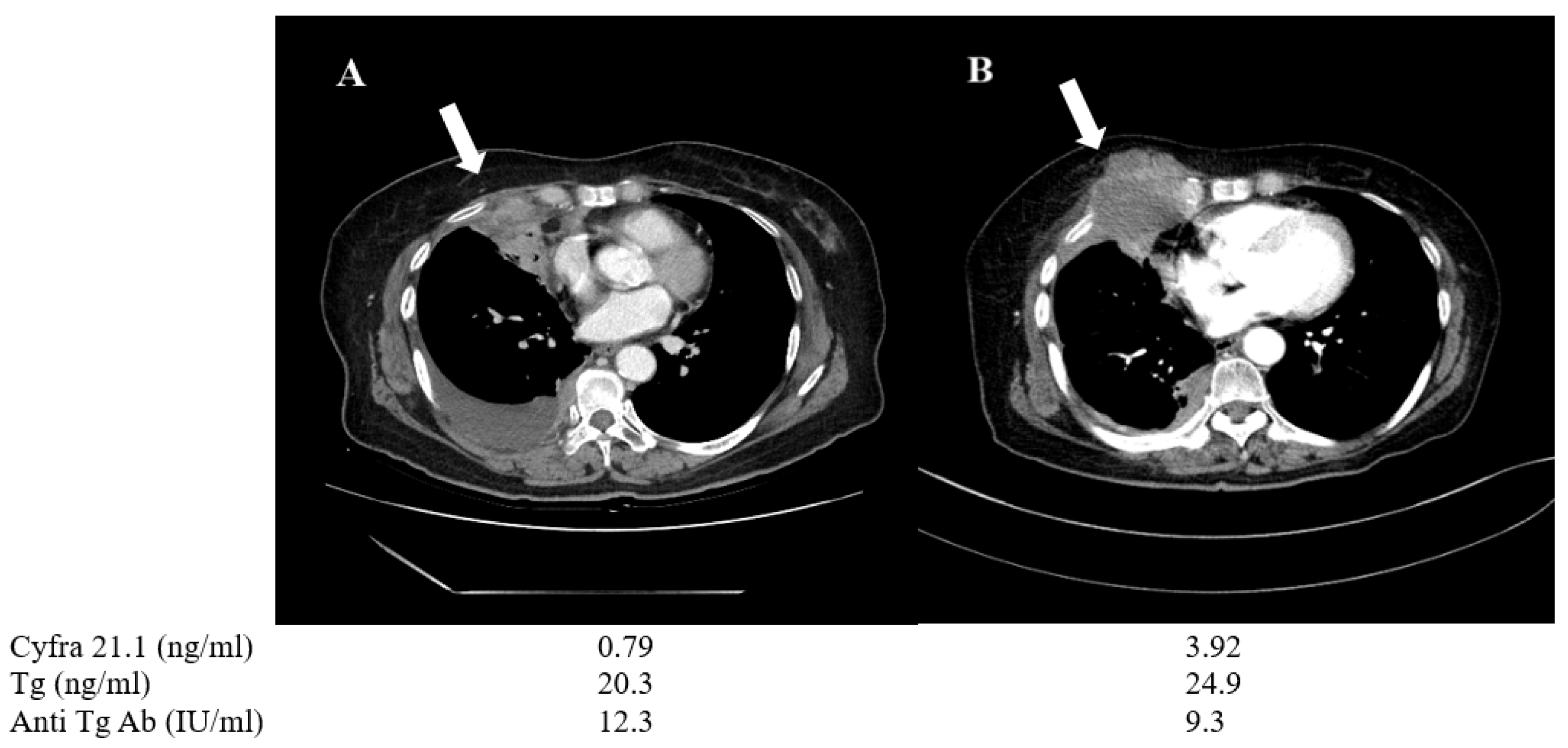 Cancers 13 00811 g006