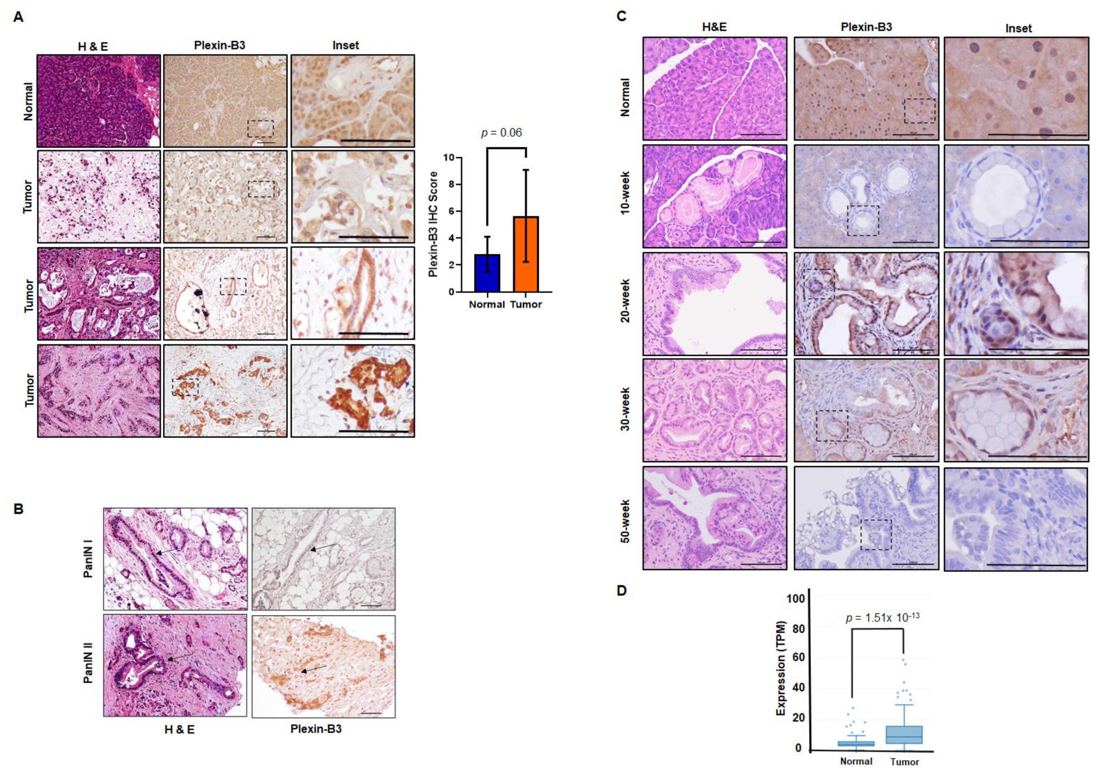 Cancers 13 00818 g001