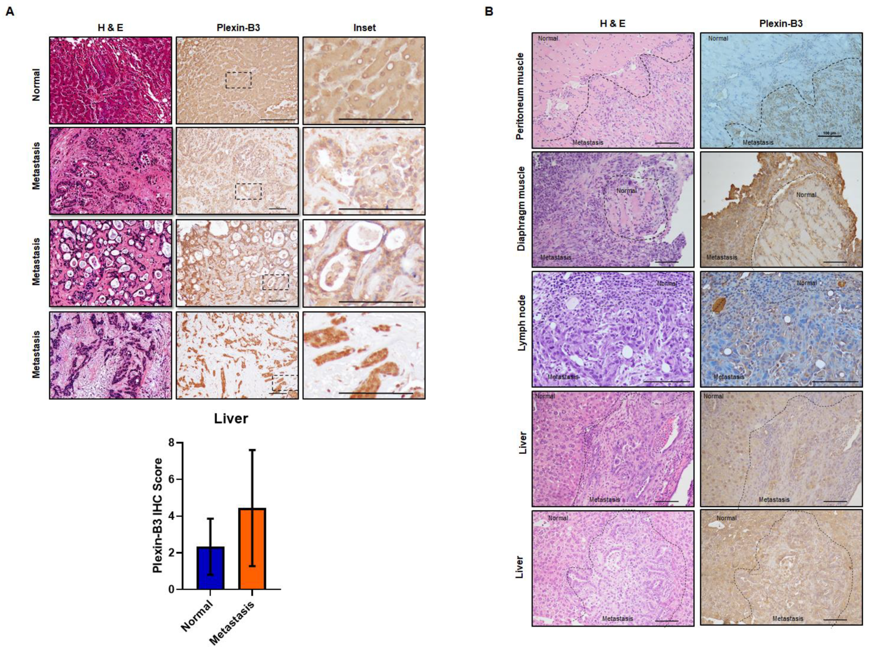 Cancers 13 00818 g002