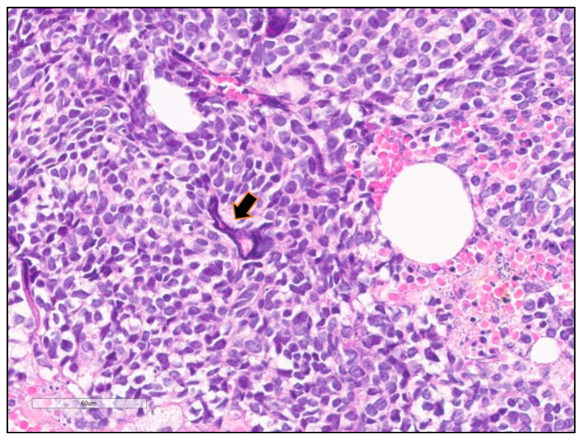 Cancers 13 00820 g004