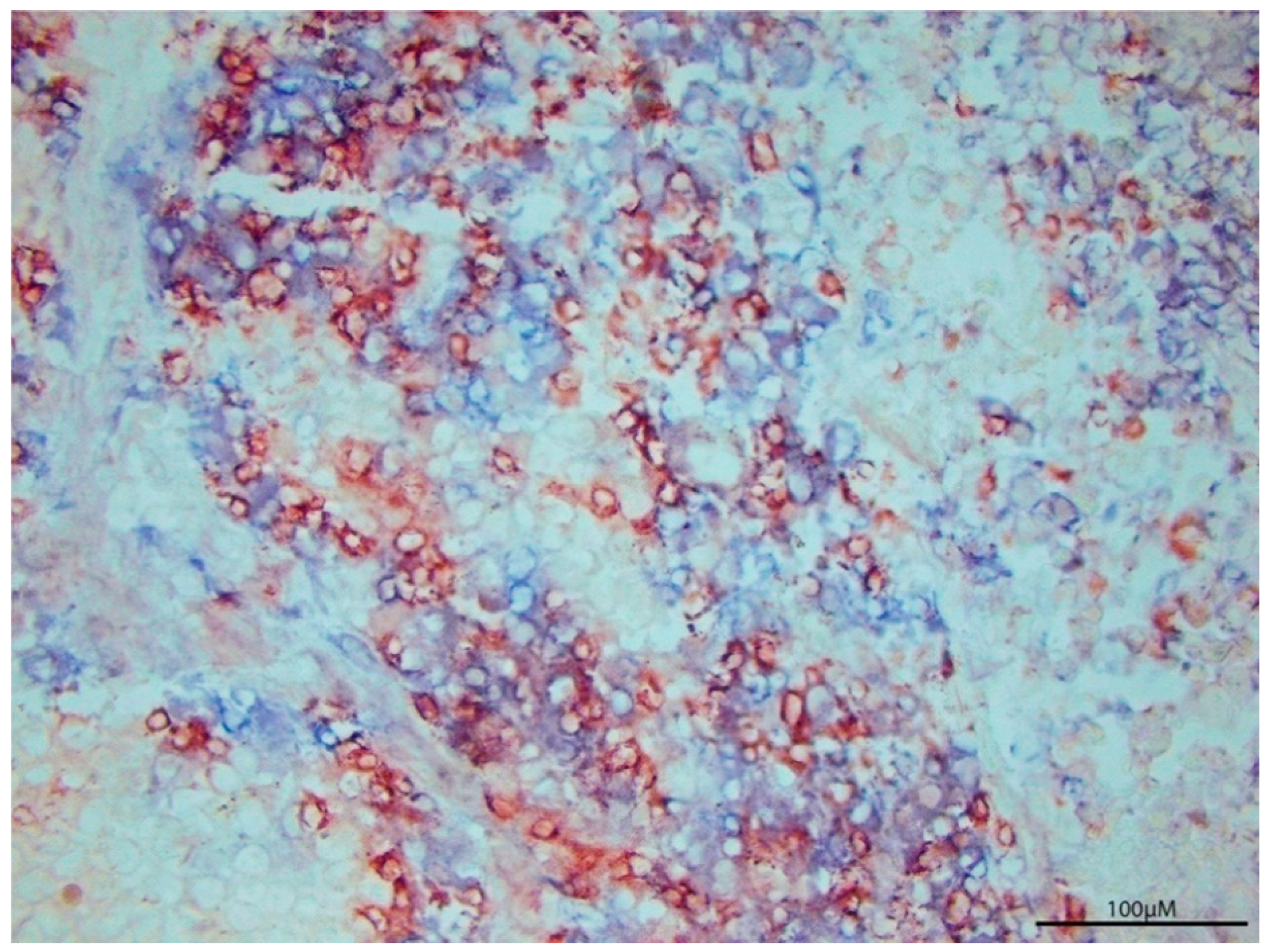 Cancers 13 00821 g001