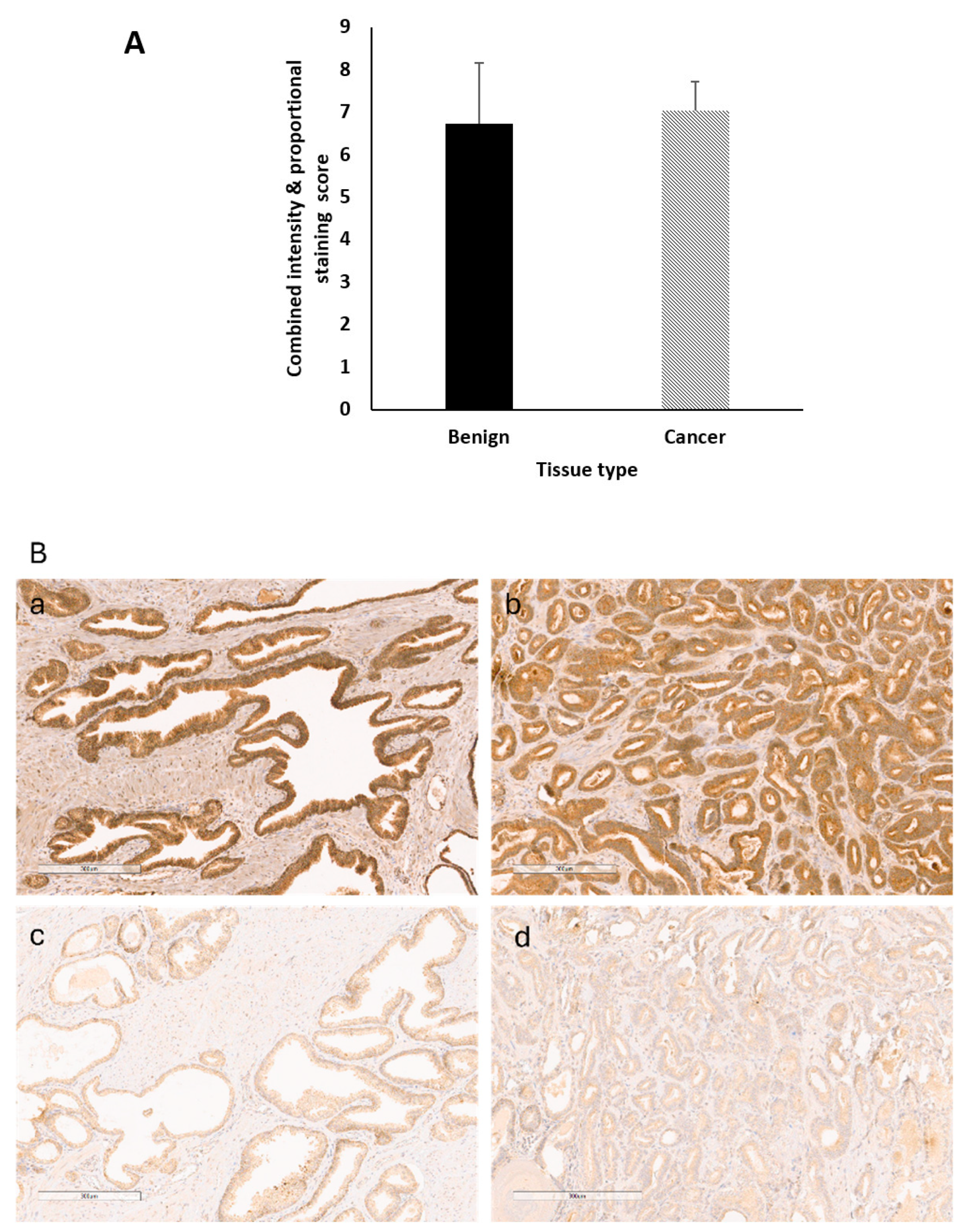 Cancers 13 00825 g005