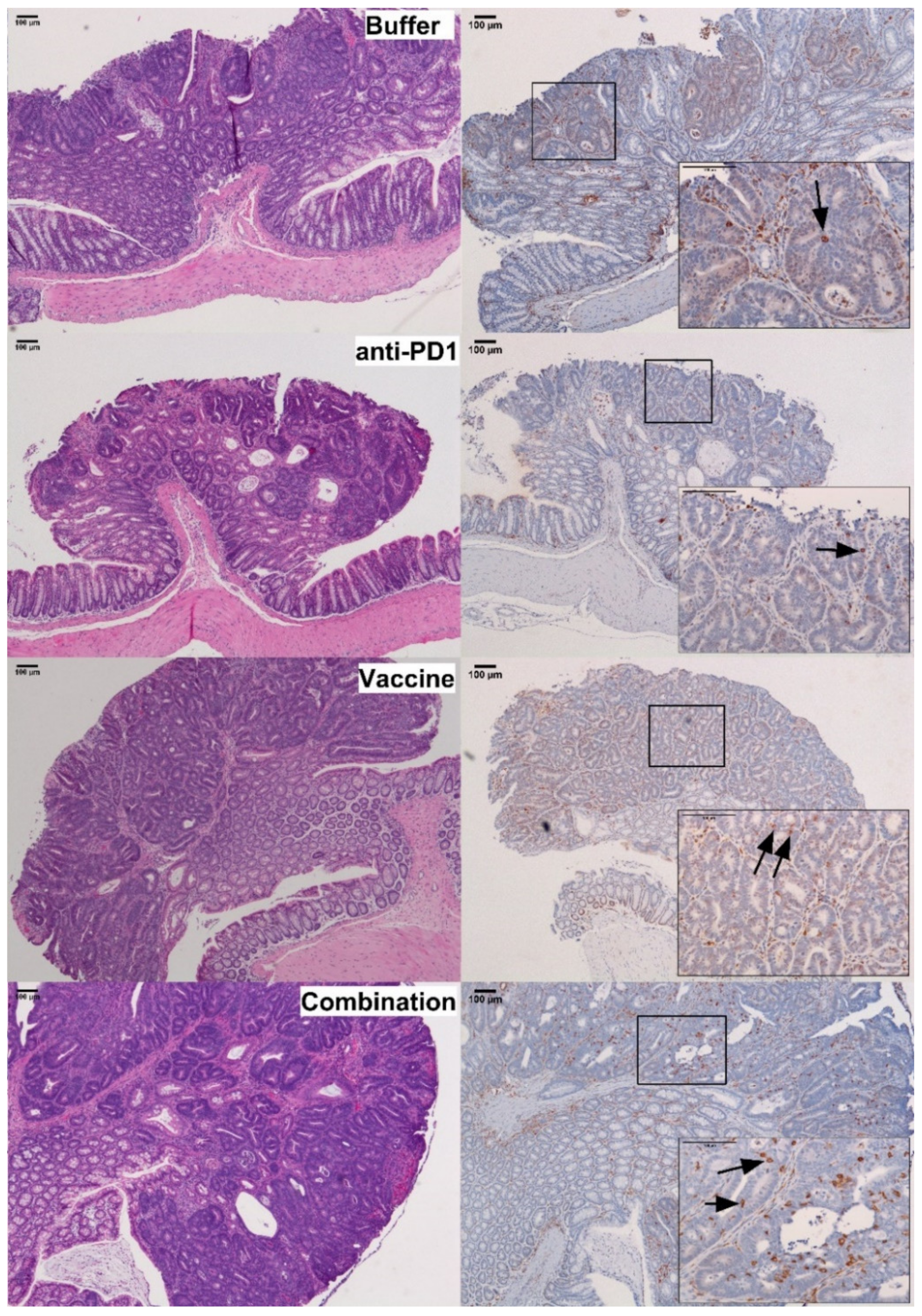 Cancers 13 00845 g005