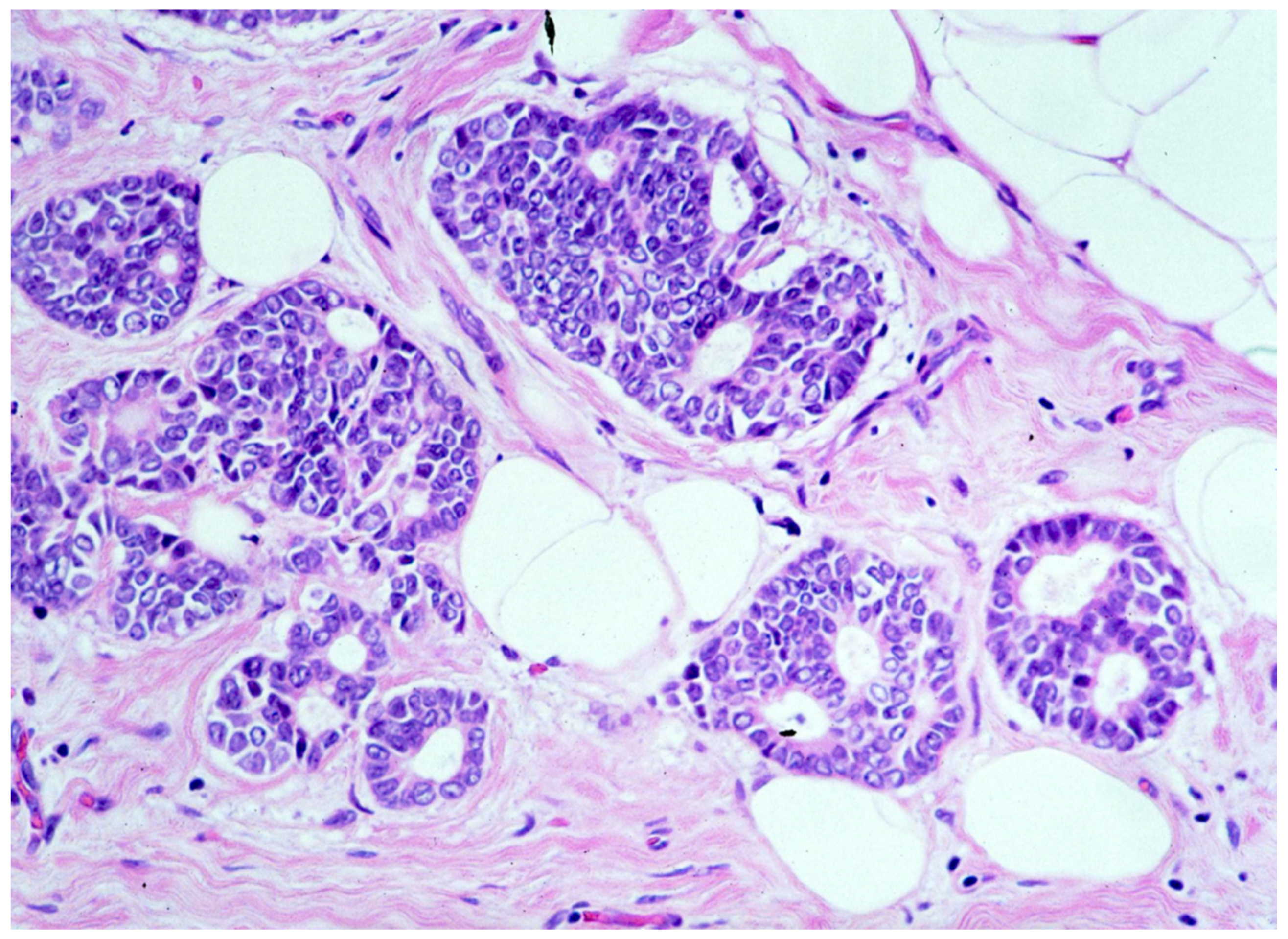 Cancers 13 00868 g003