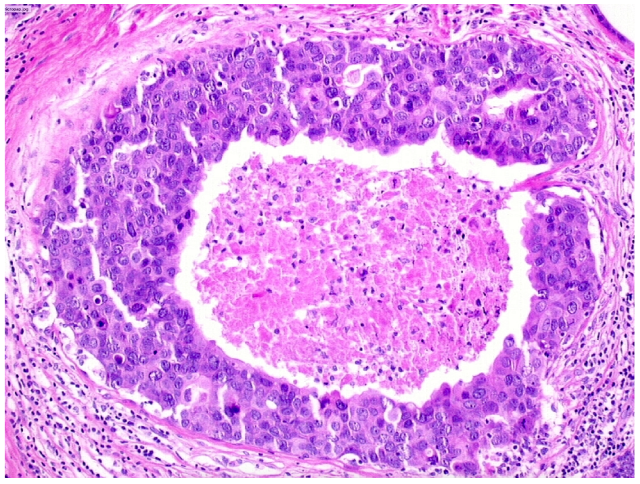 Cancers 13 00868 g004