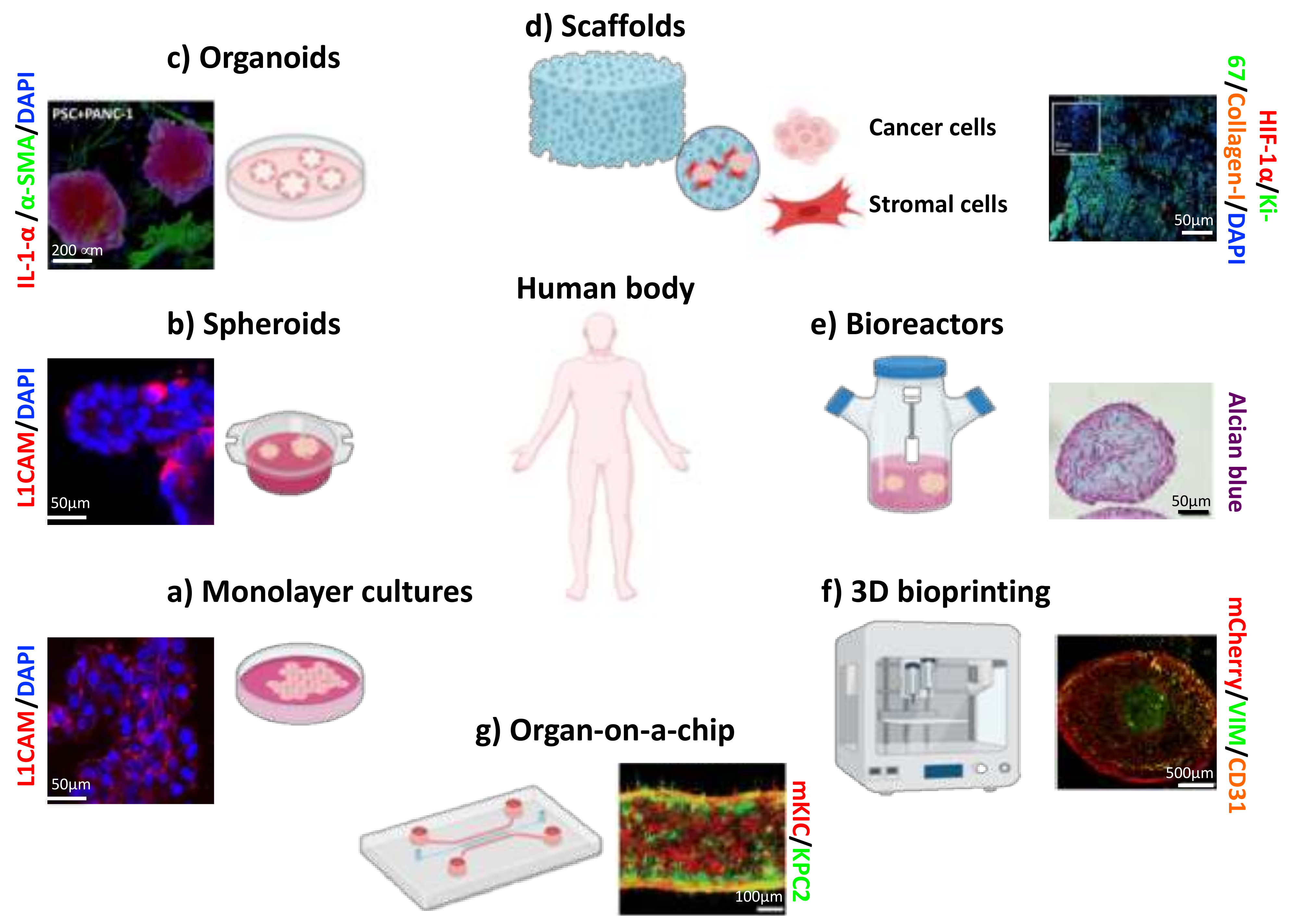 Cancers 13 00930 g006