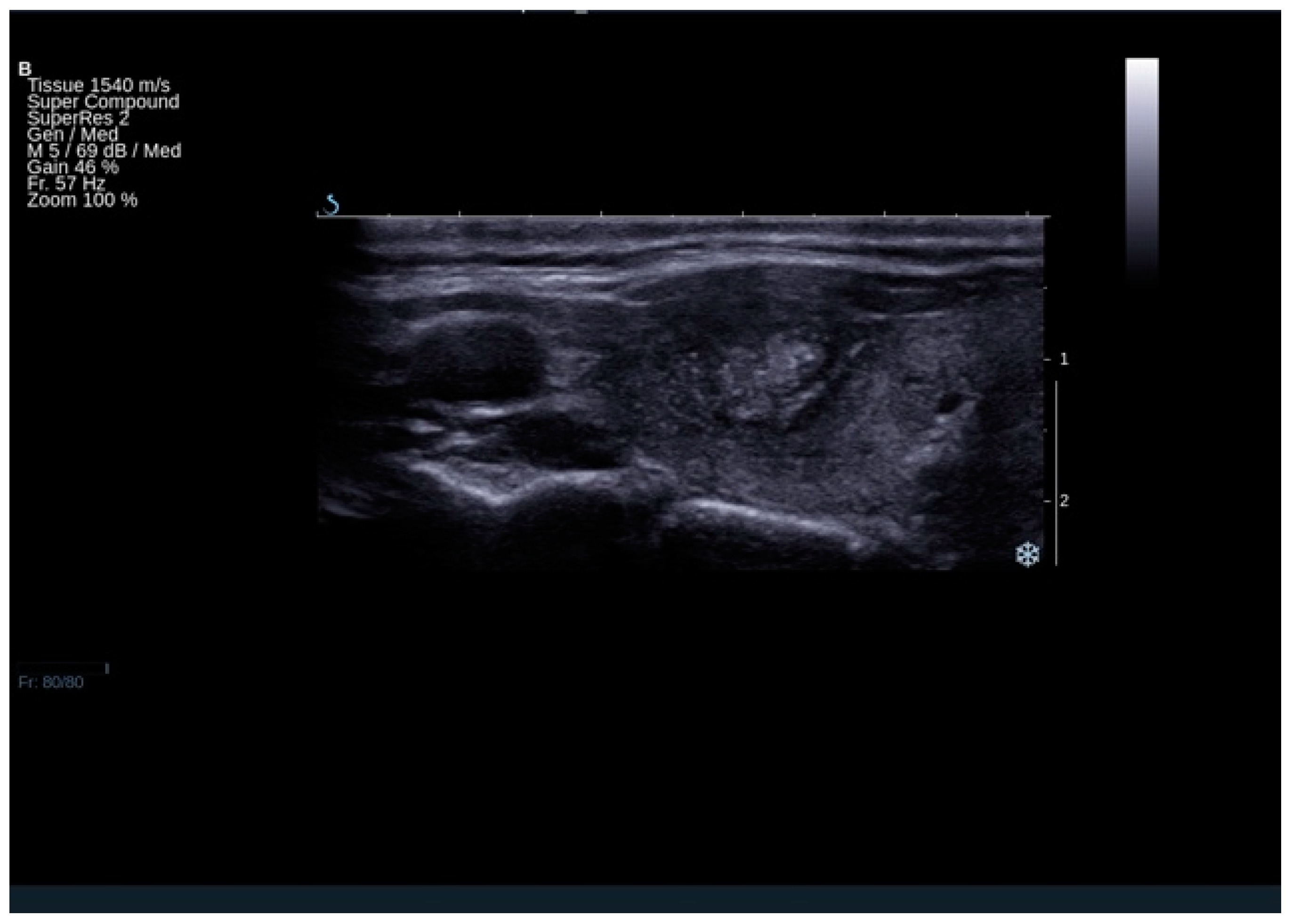 Cancers 13 00938 g003