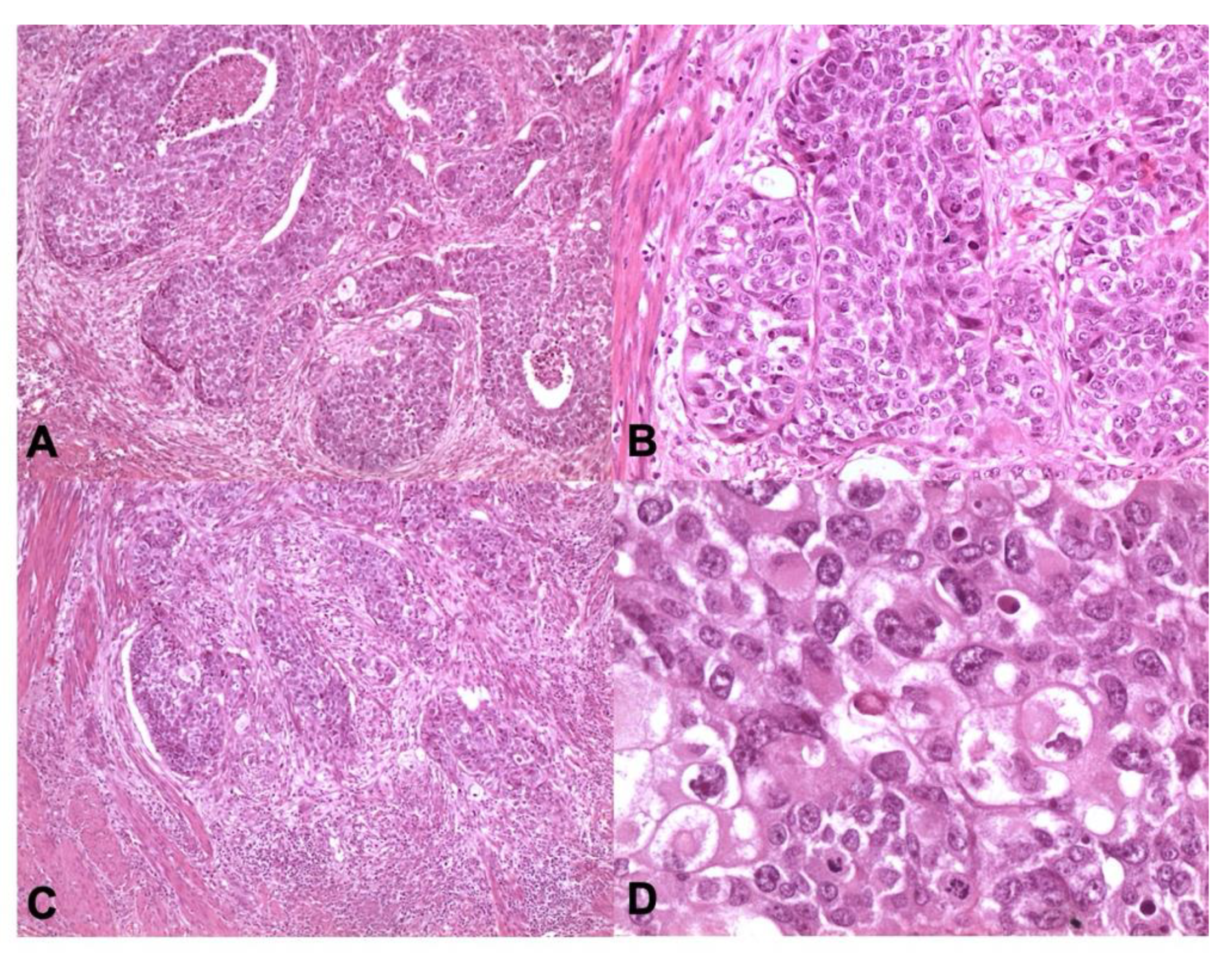 Cancers 13 00950 g004 Cancers 13 00950 g004