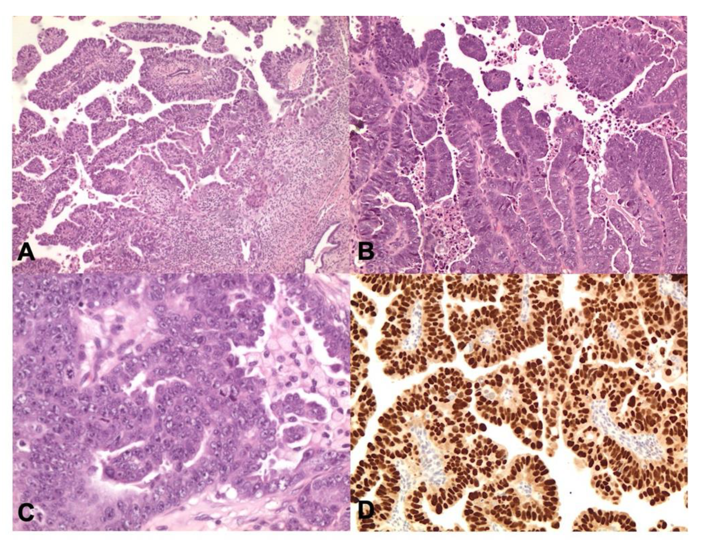 Cancers 13 00950 g006 Cancers 13 00950 g006