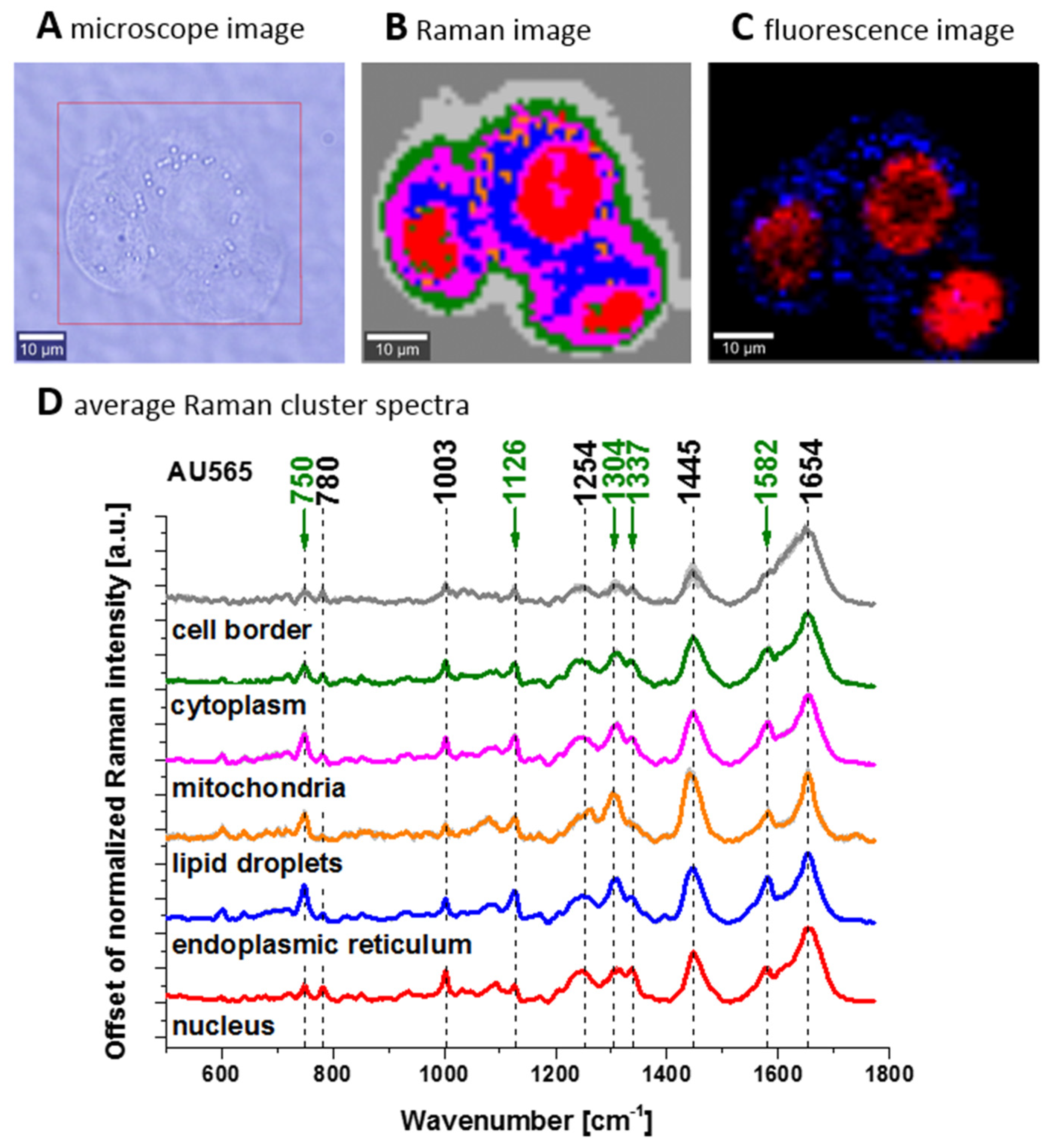 Cancers 13 00960 g004
