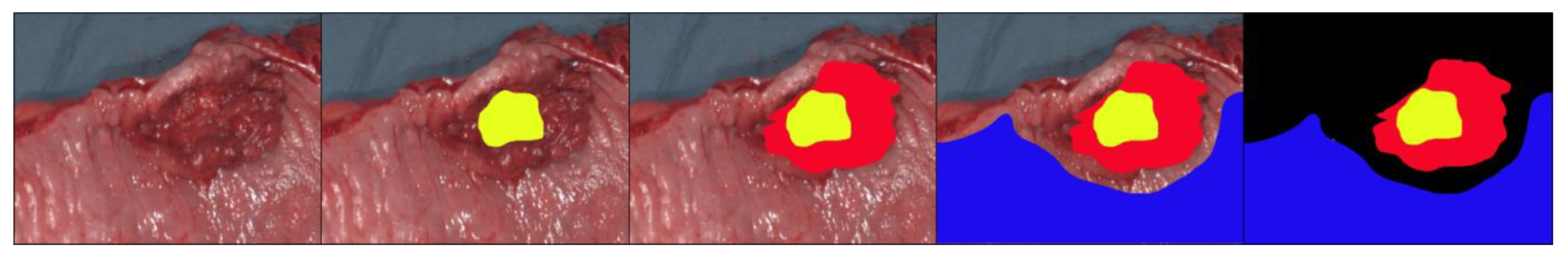 Cancers 13 00967 g001