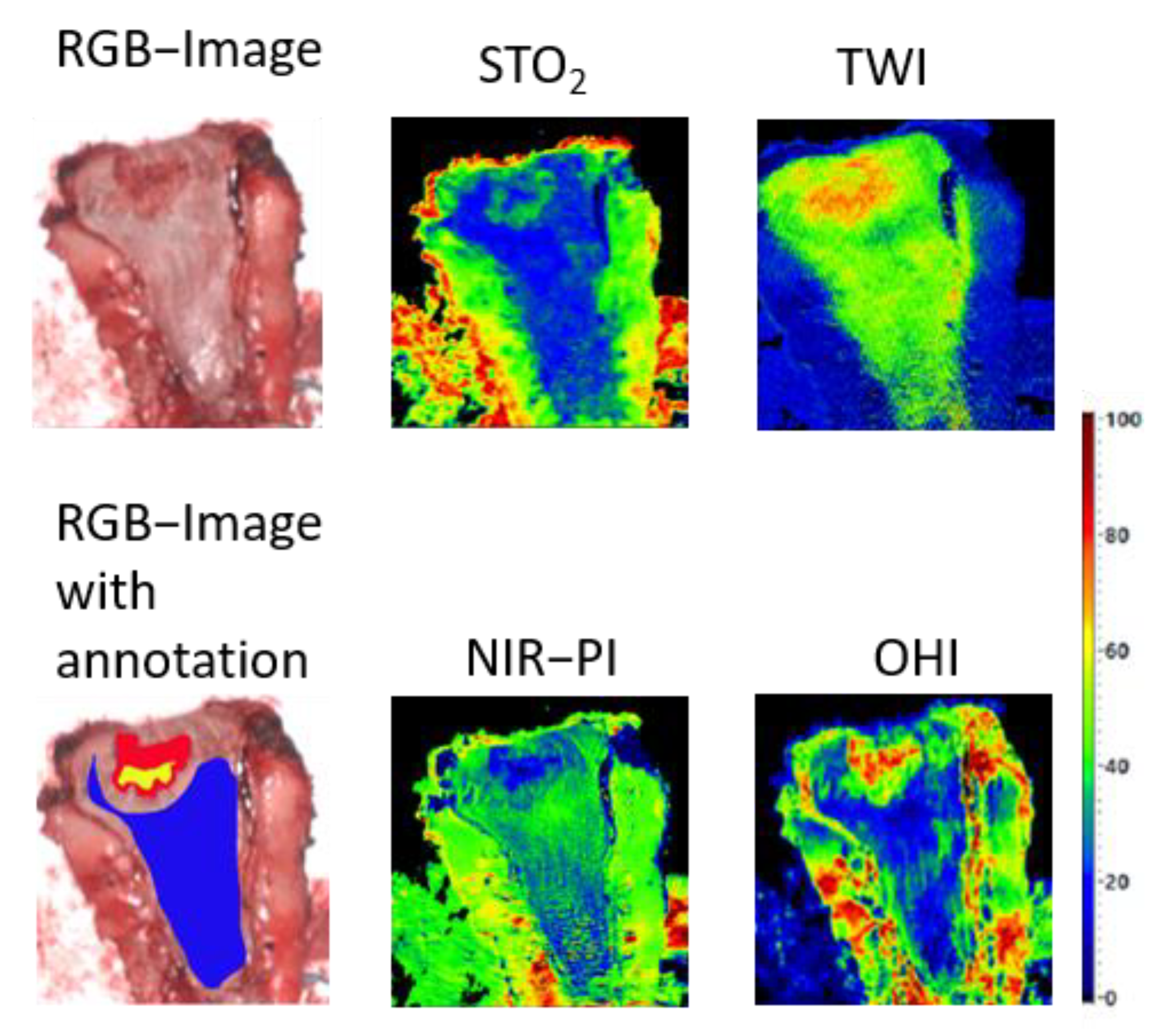 Cancers 13 00967 g005