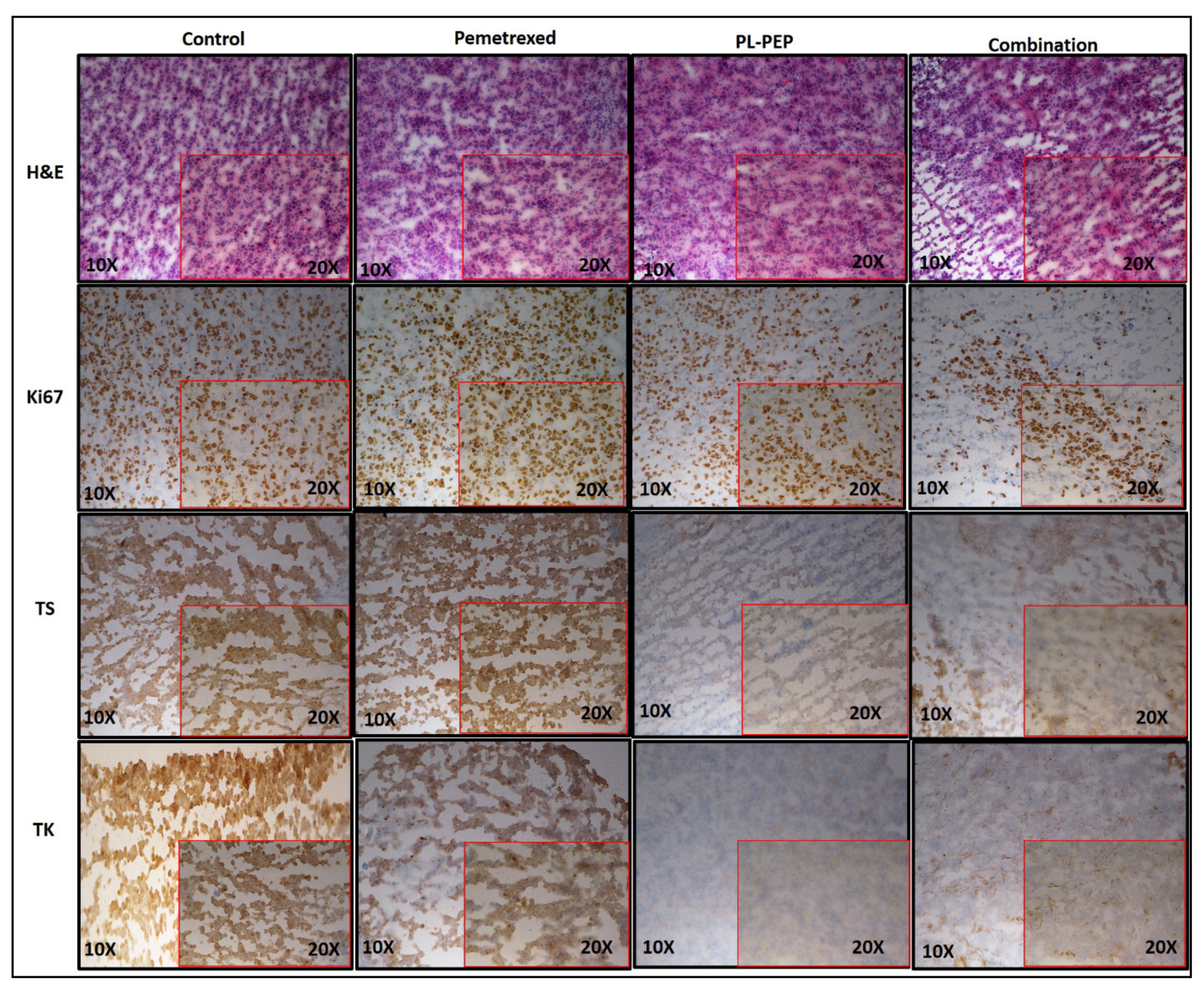 Cancers 13 00972 g008