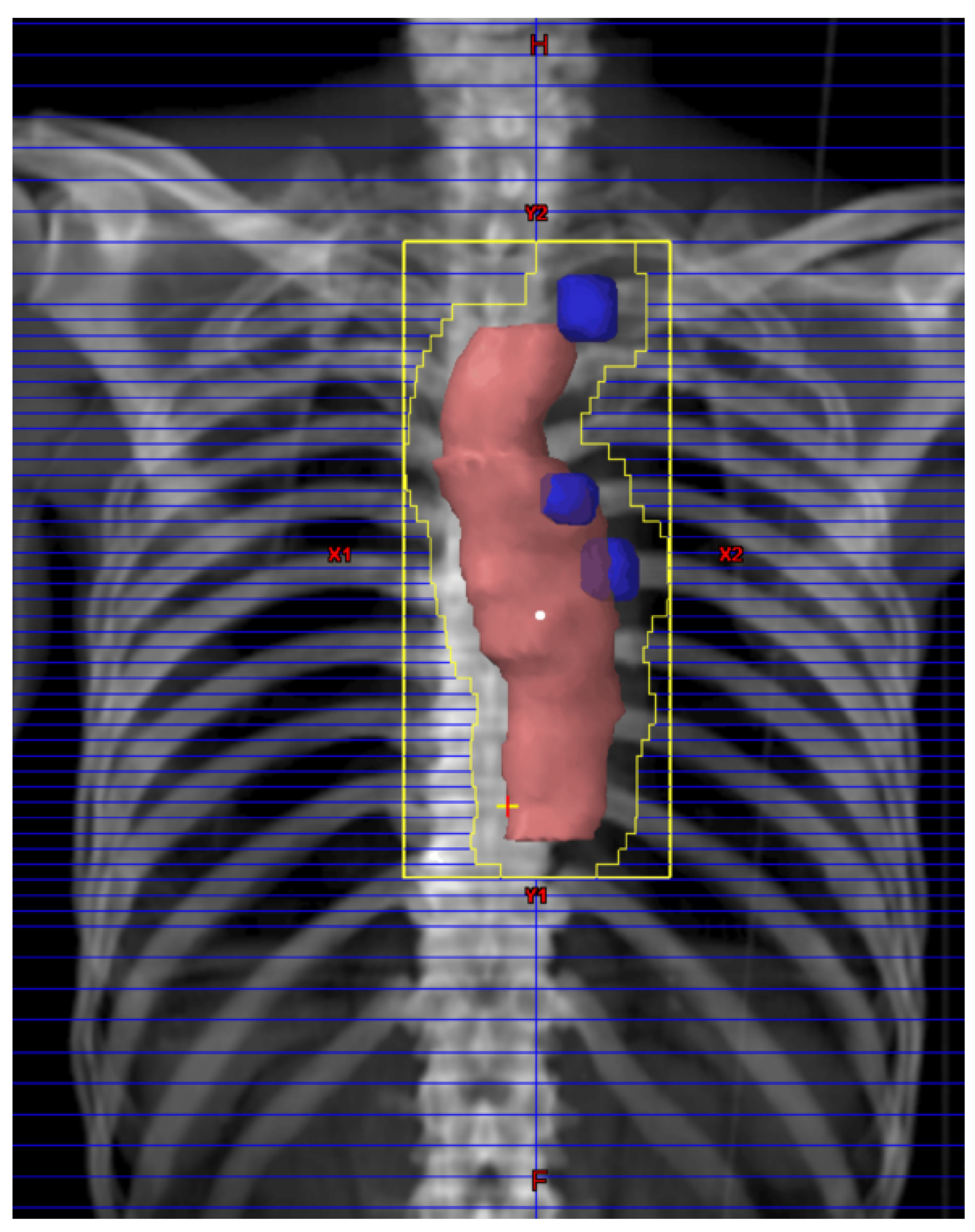 Cancers 13 00983 g001