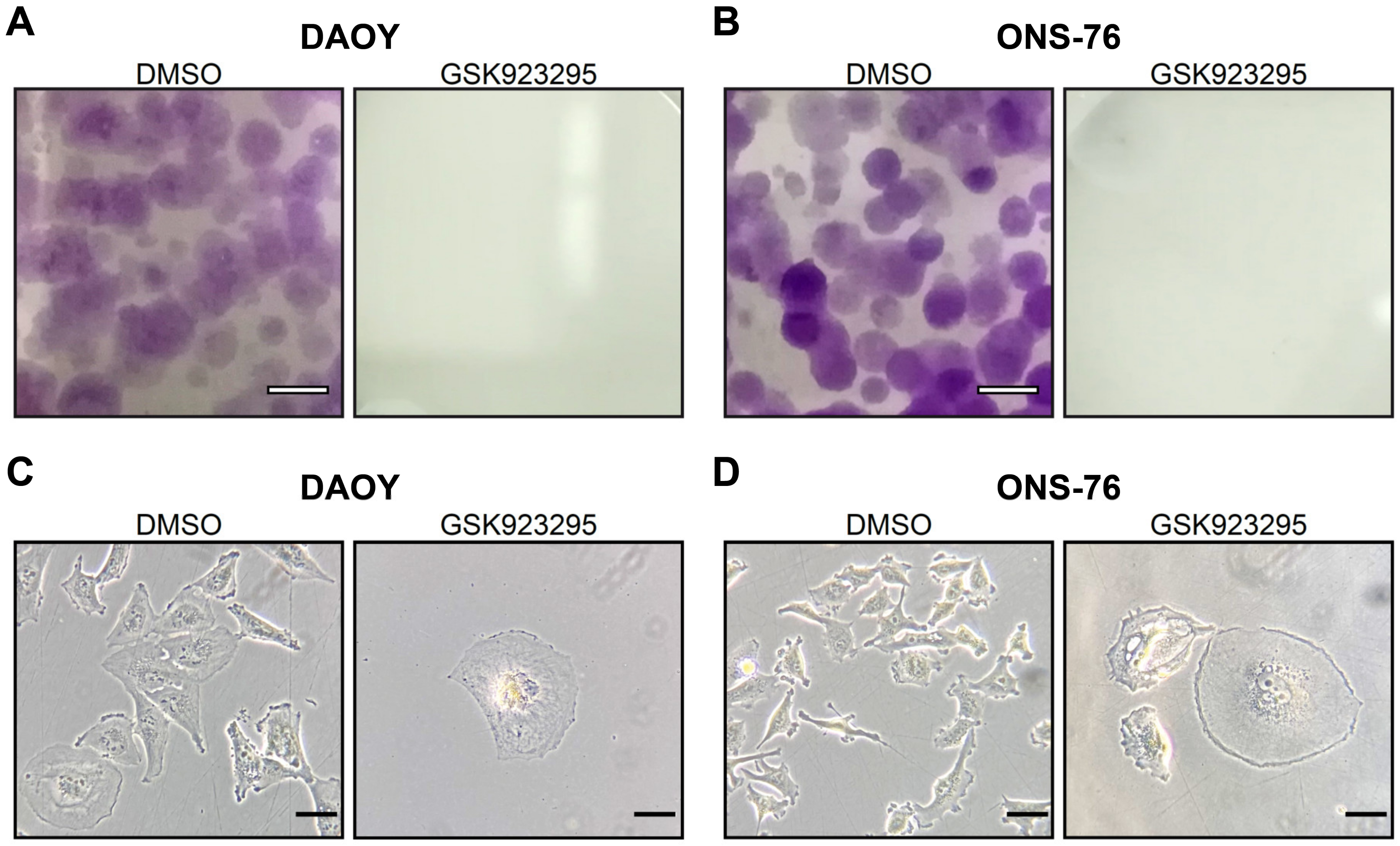 Cancers 13 01028 g005