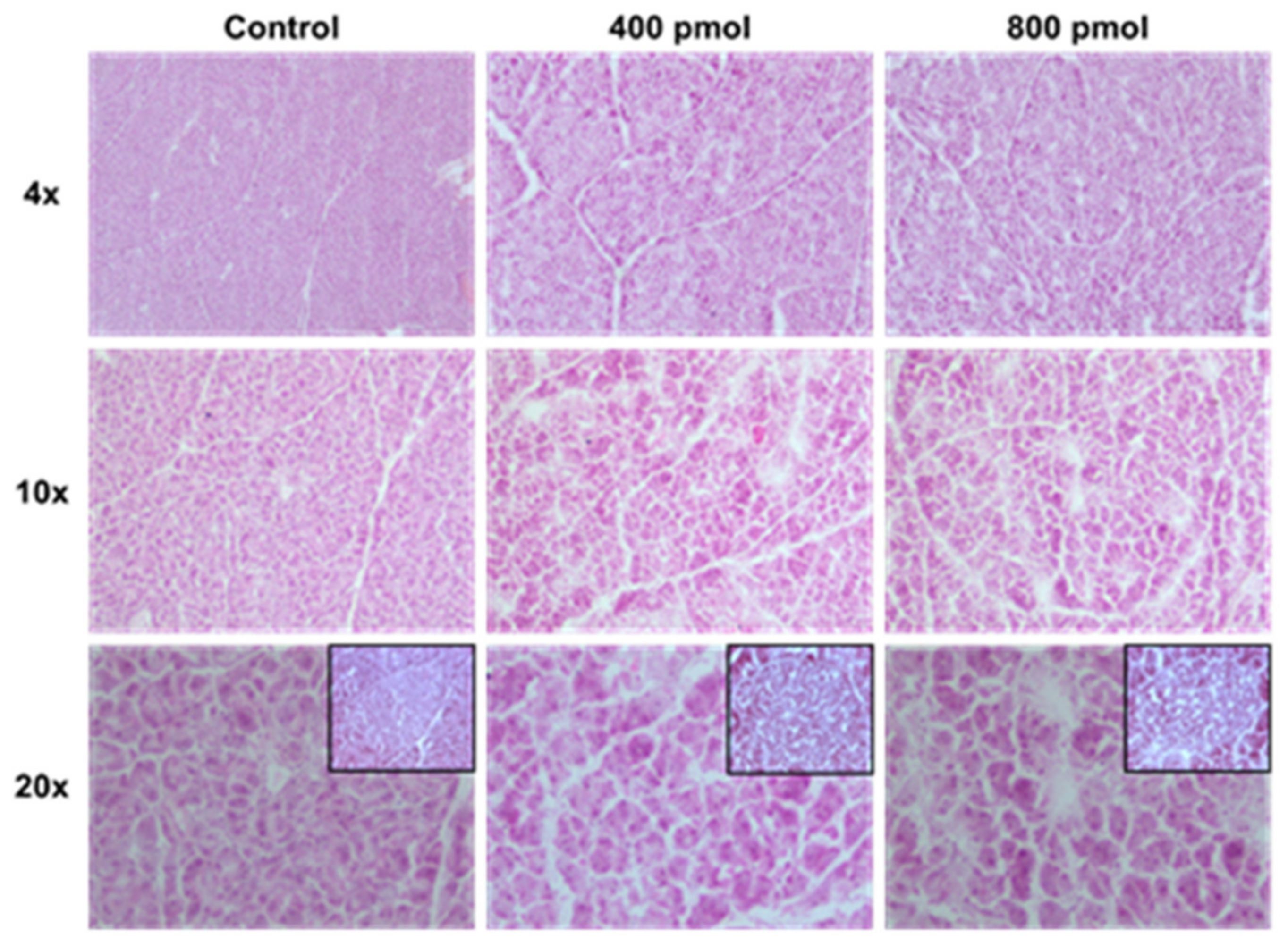 Cancers 13 01051 g005