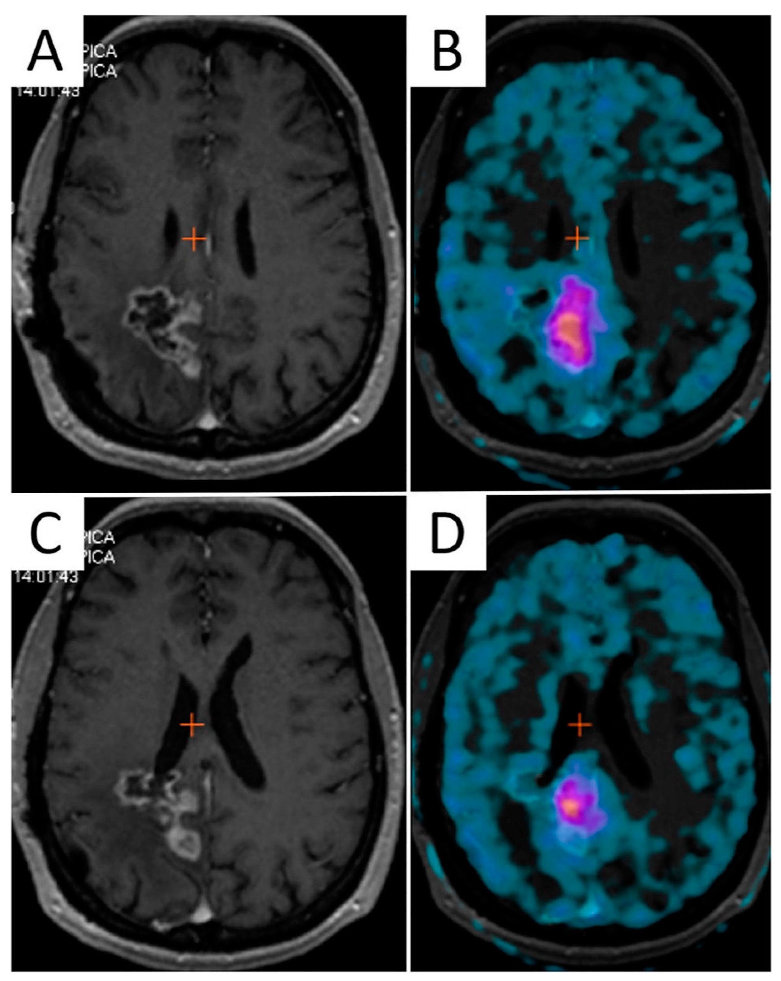 Cancers 13 01063 g003