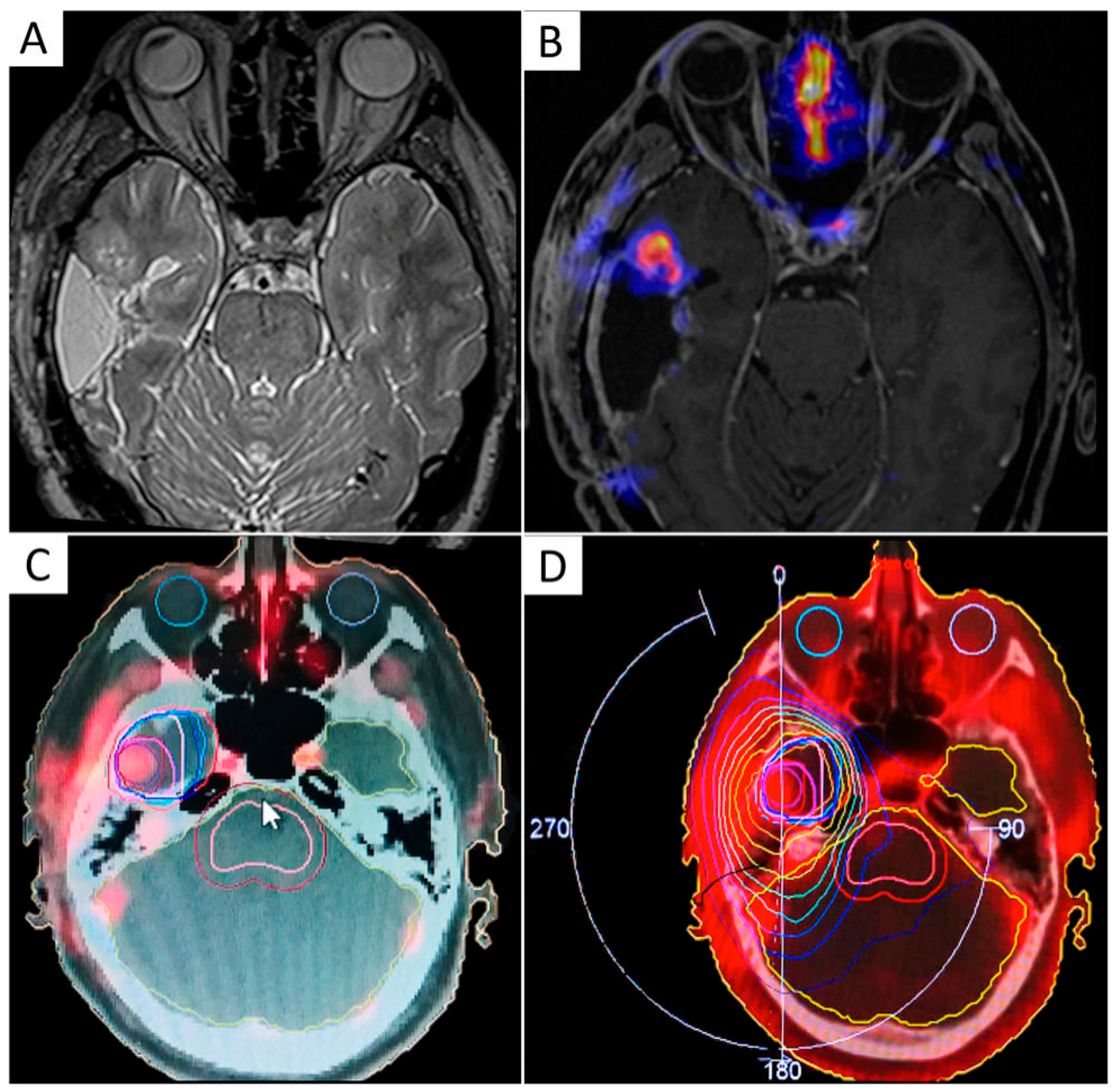 Cancers 13 01063 g004
