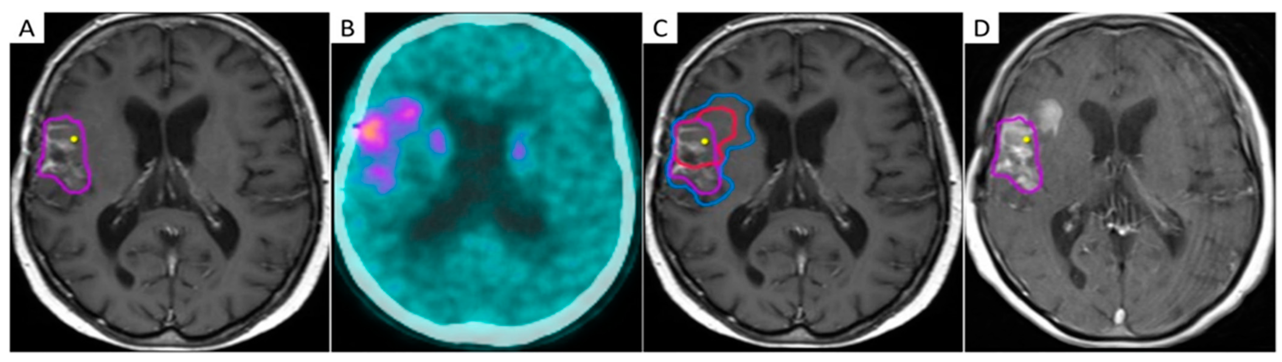 Cancers 13 01063 g005