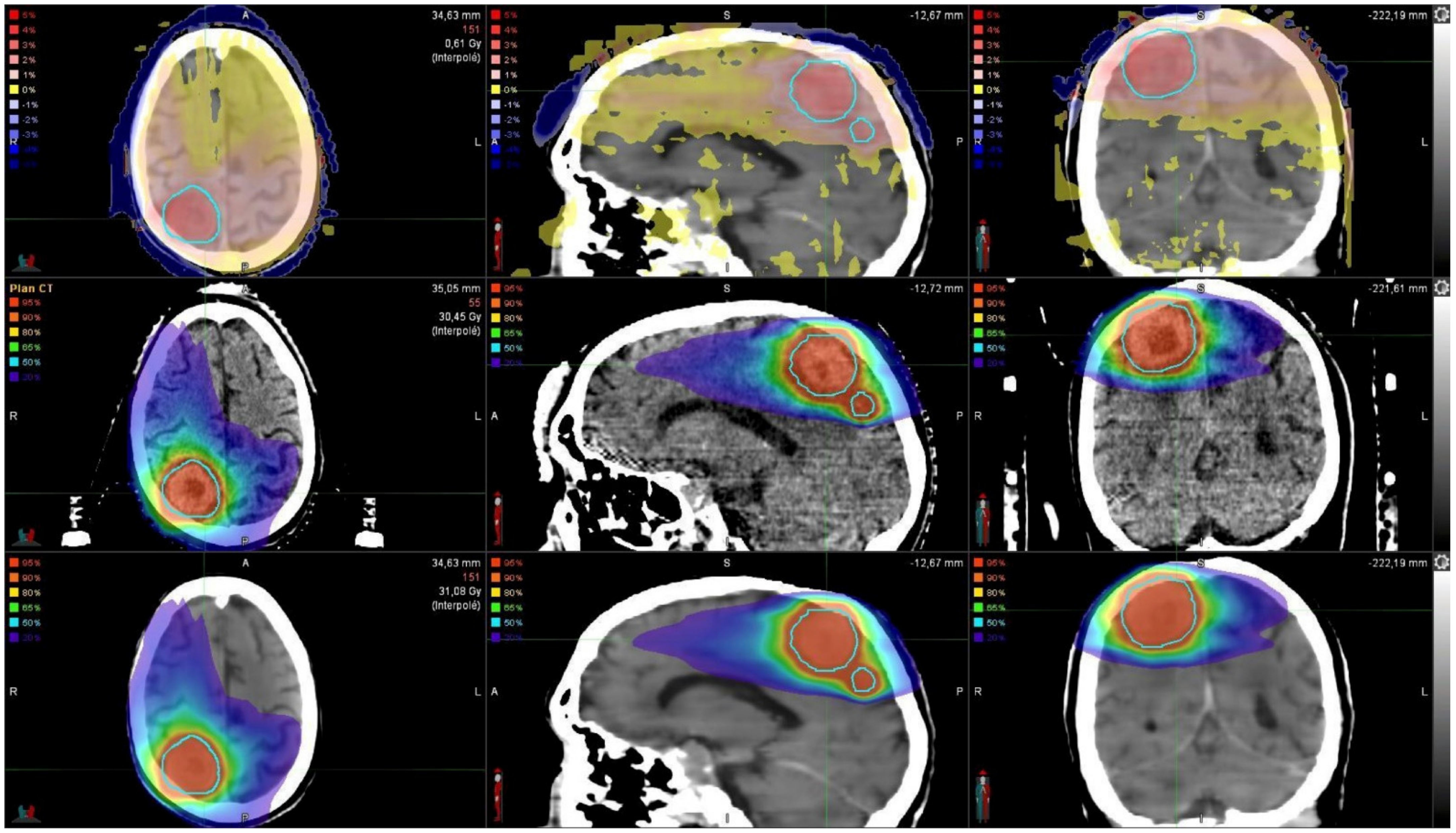 Cancers 13 01082 g001