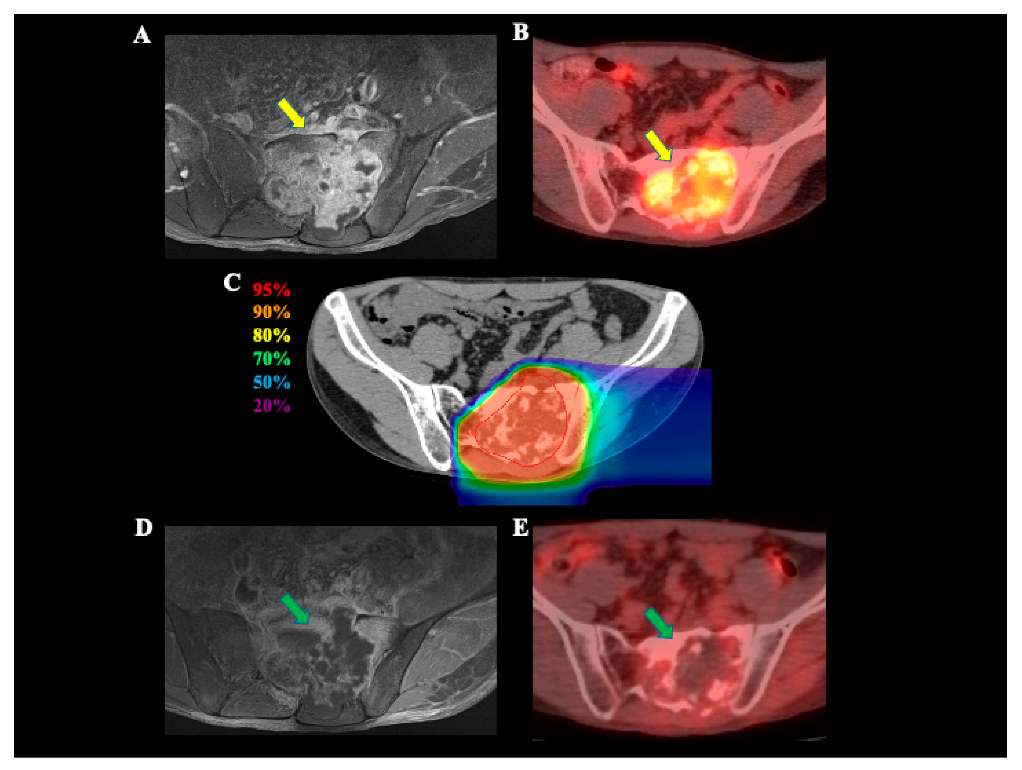 Cancers 13 01099 g001