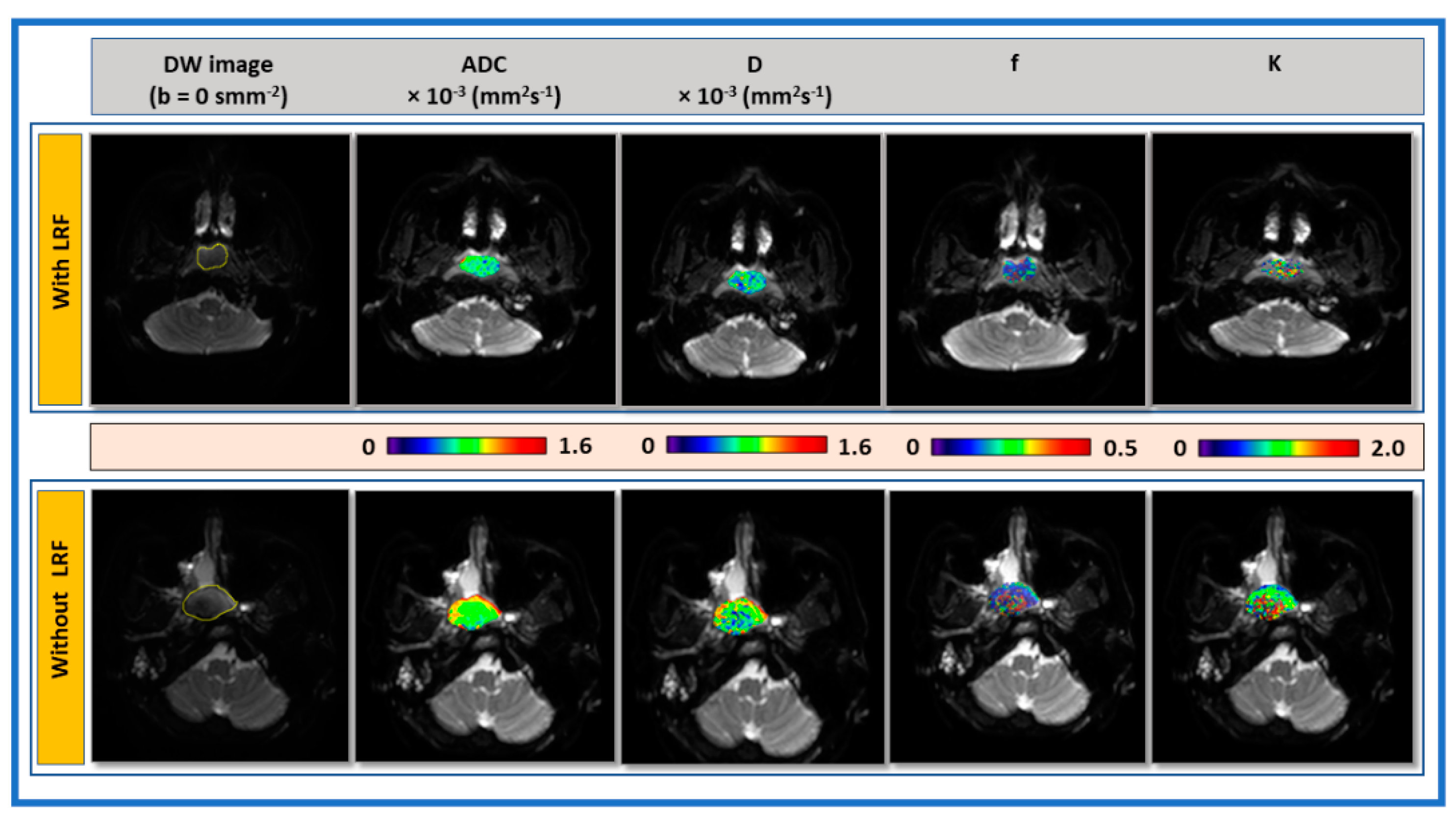 Cancers 13 01128 g002 Cancers 13 01128 g002