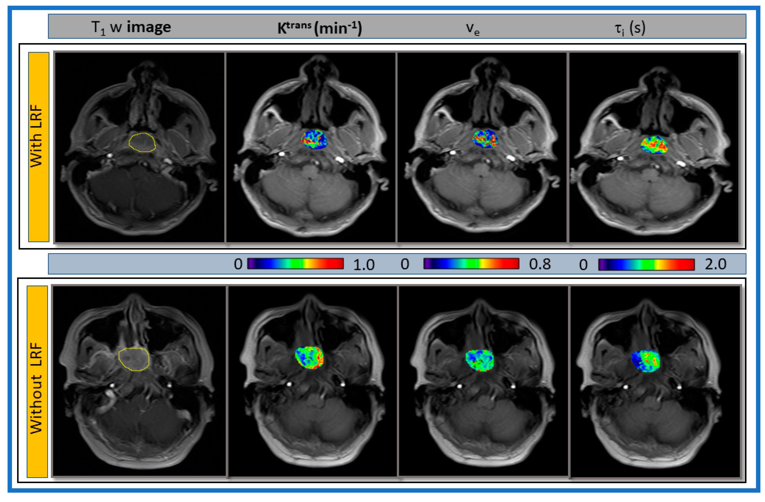 Cancers 13 01128 g005 Cancers 13 01128 g005