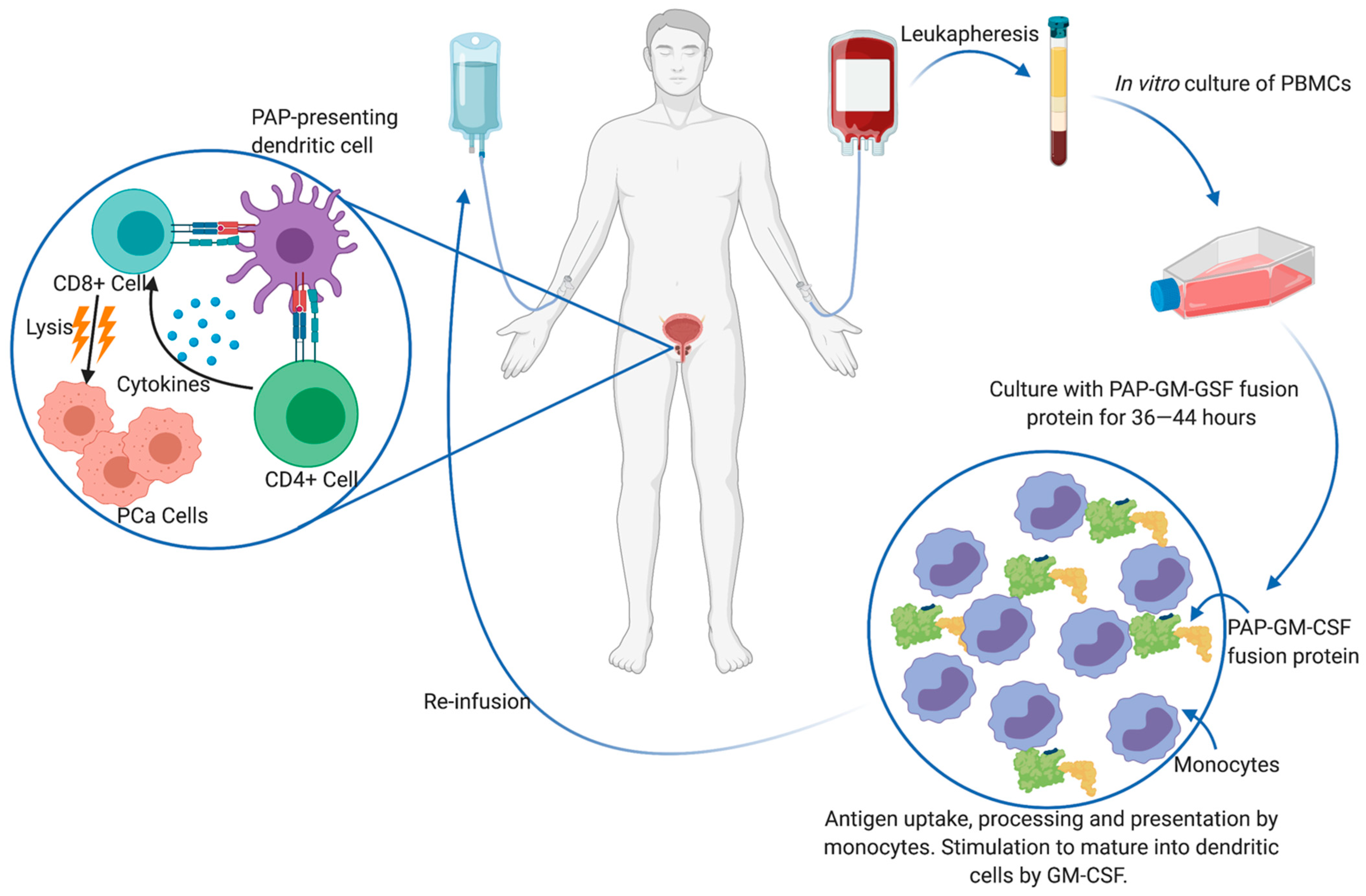 Cancers 13 01145 g003 Cancers 13 01145 g003