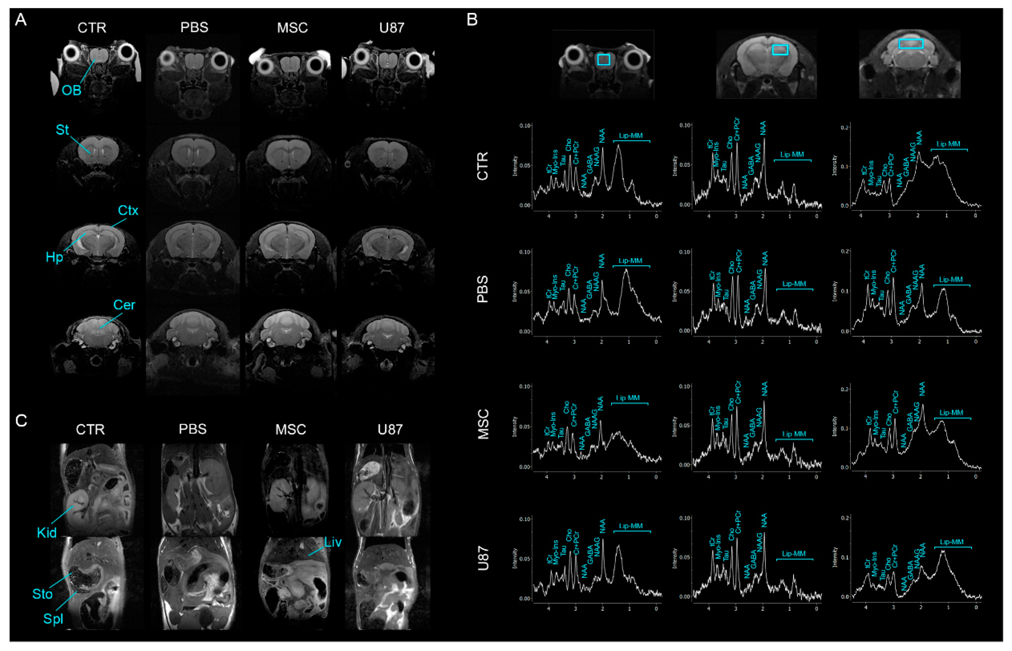 Cancers 13 01169 g004 Cancers 13 01169 g004