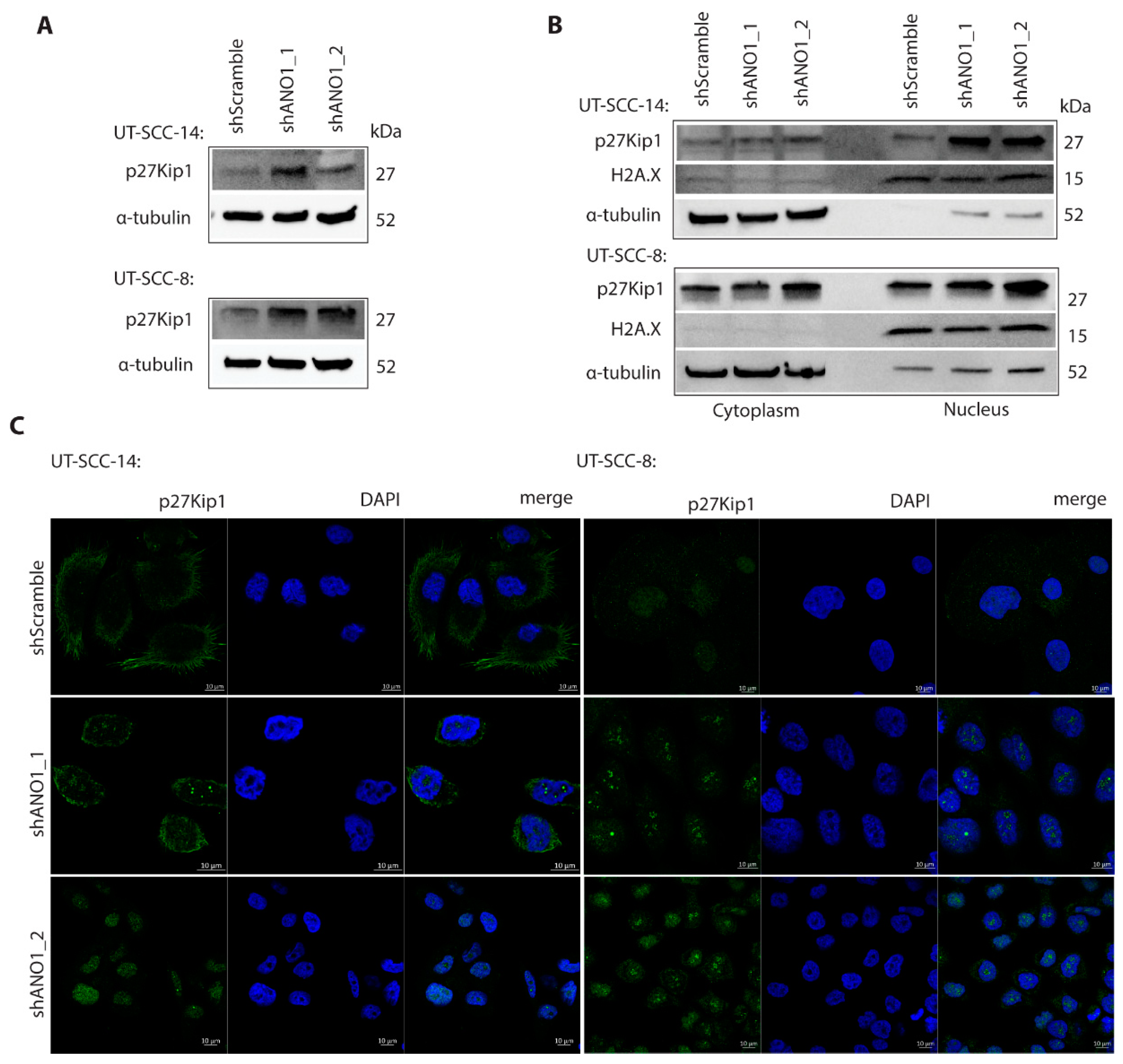 Cancers 13 01170 g004