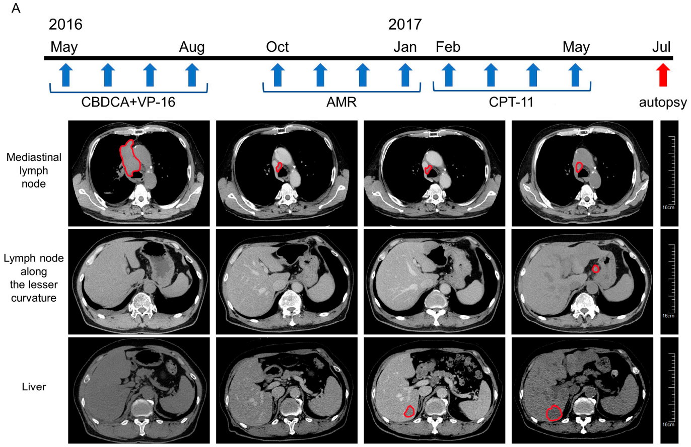 Cancers 13 01187 g001a