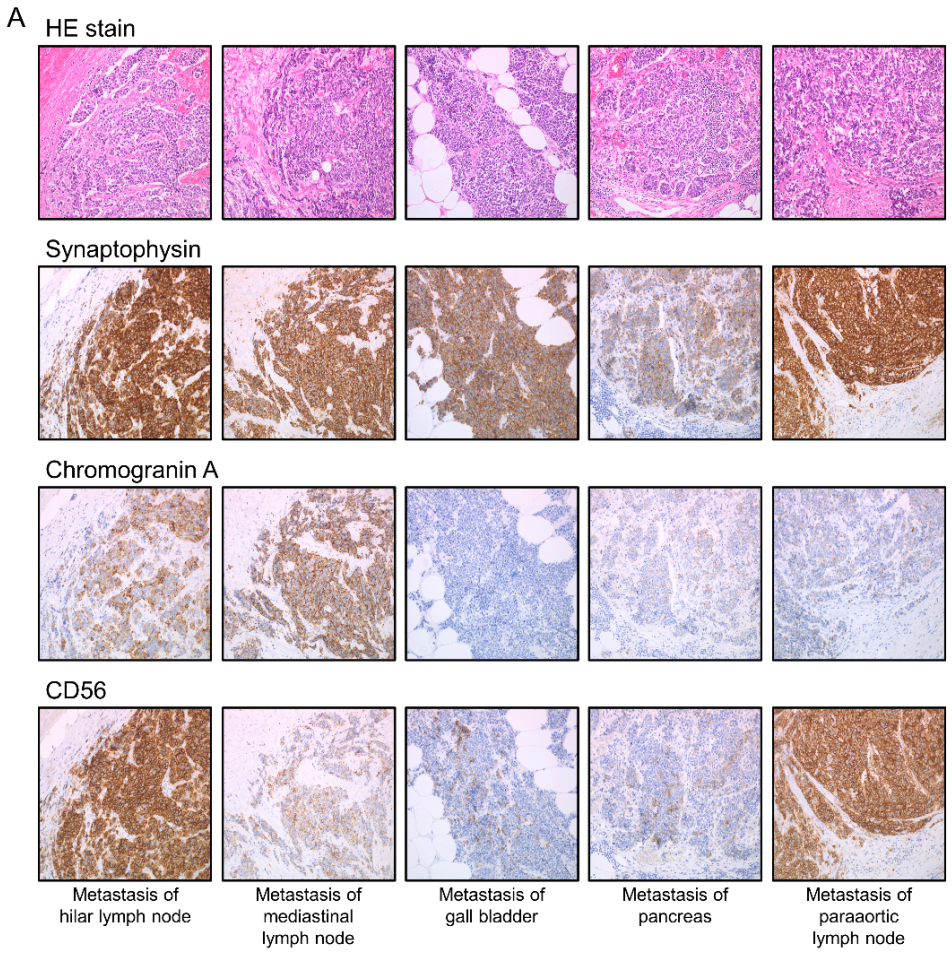 Cancers 13 01187 g002a