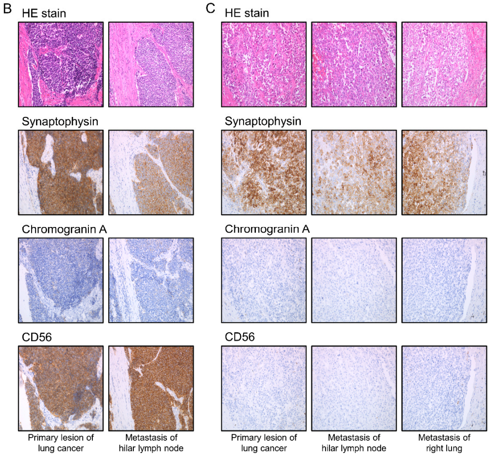 Cancers 13 01187 g002b