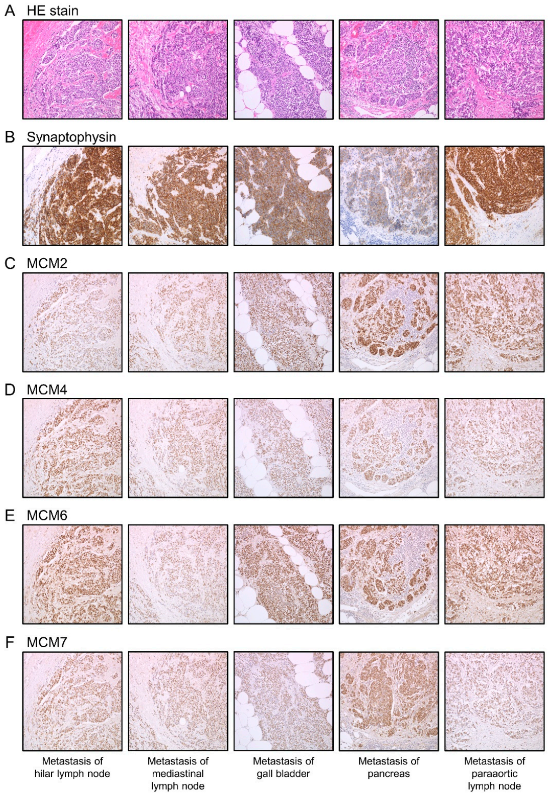 Cancers 13 01187 g003