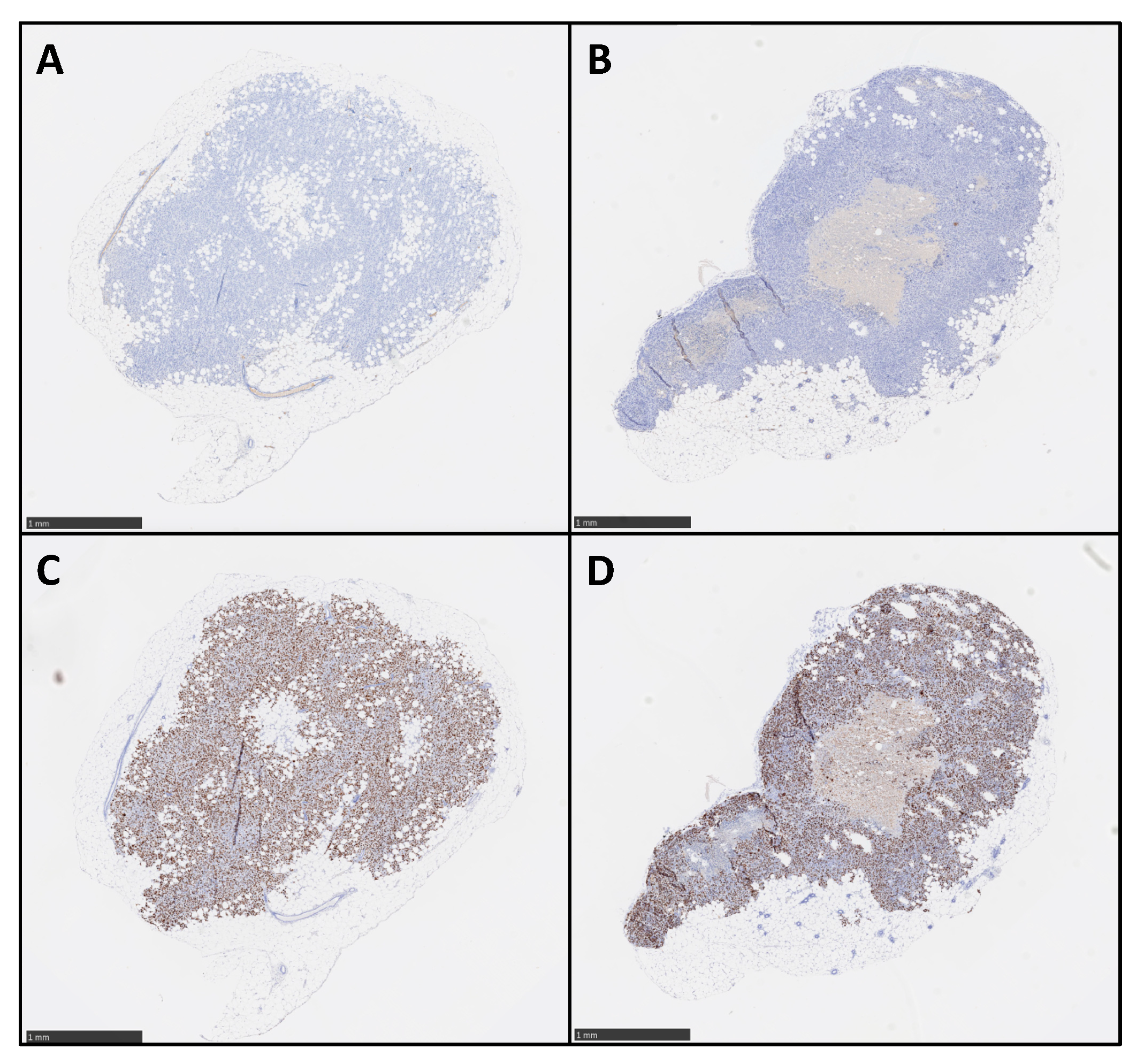 Cancers 13 01256 g002