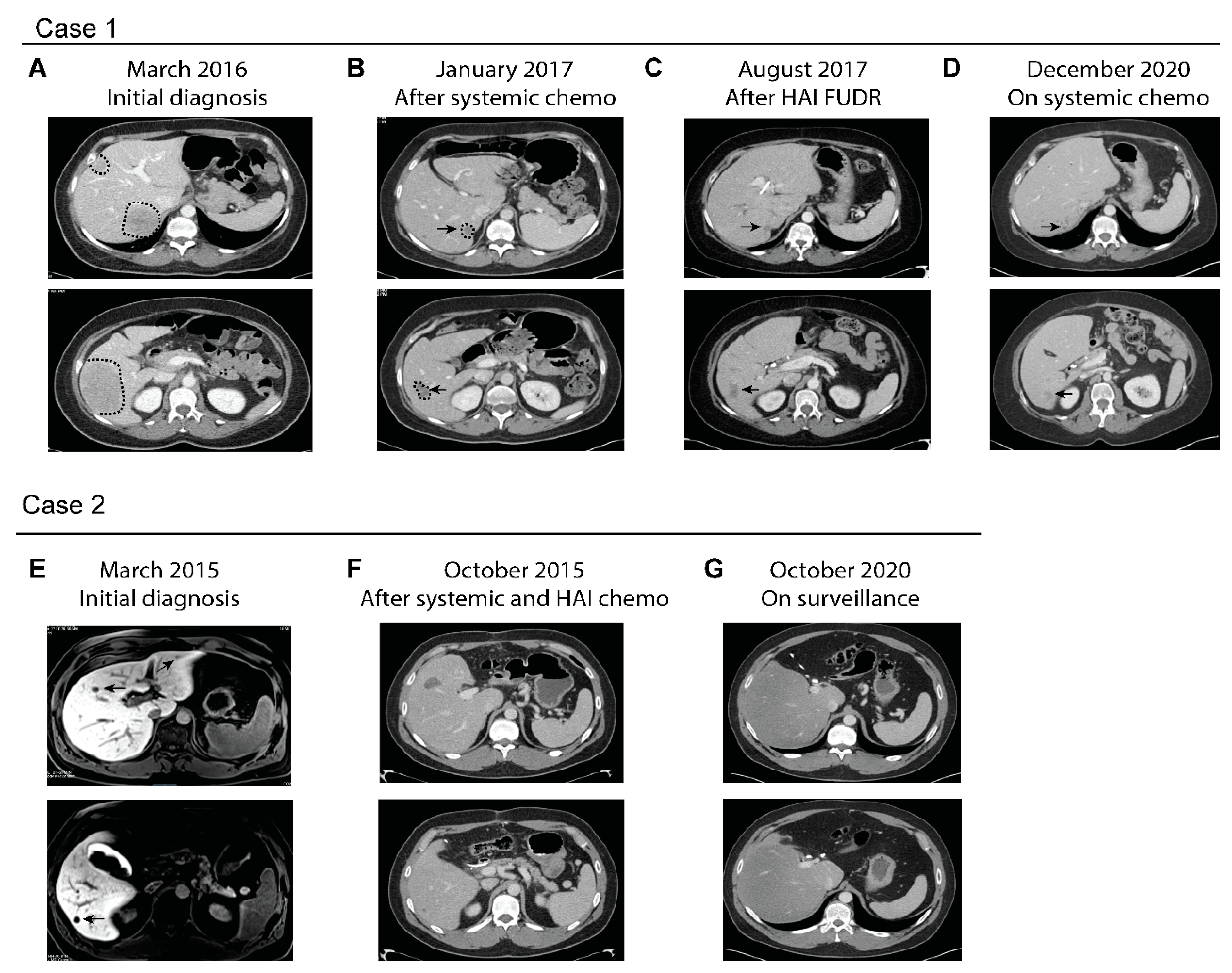 Cancers 13 01283 g001