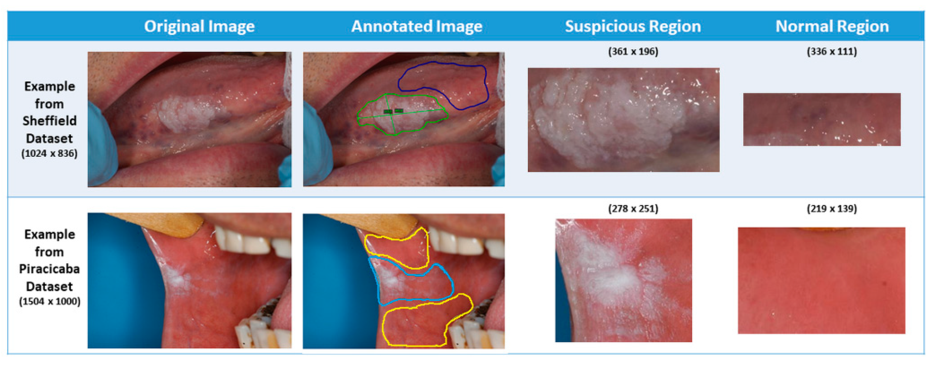 Cancers 13 01291 g002