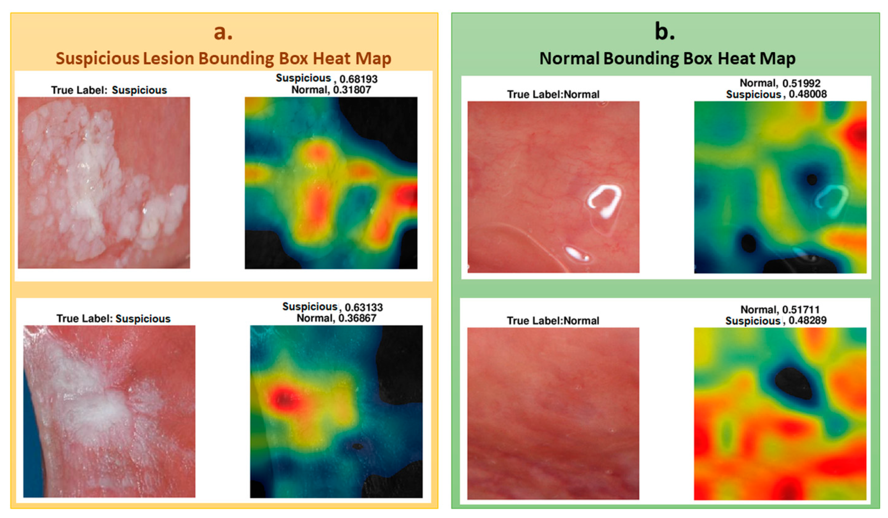 Cancers 13 01291 g006