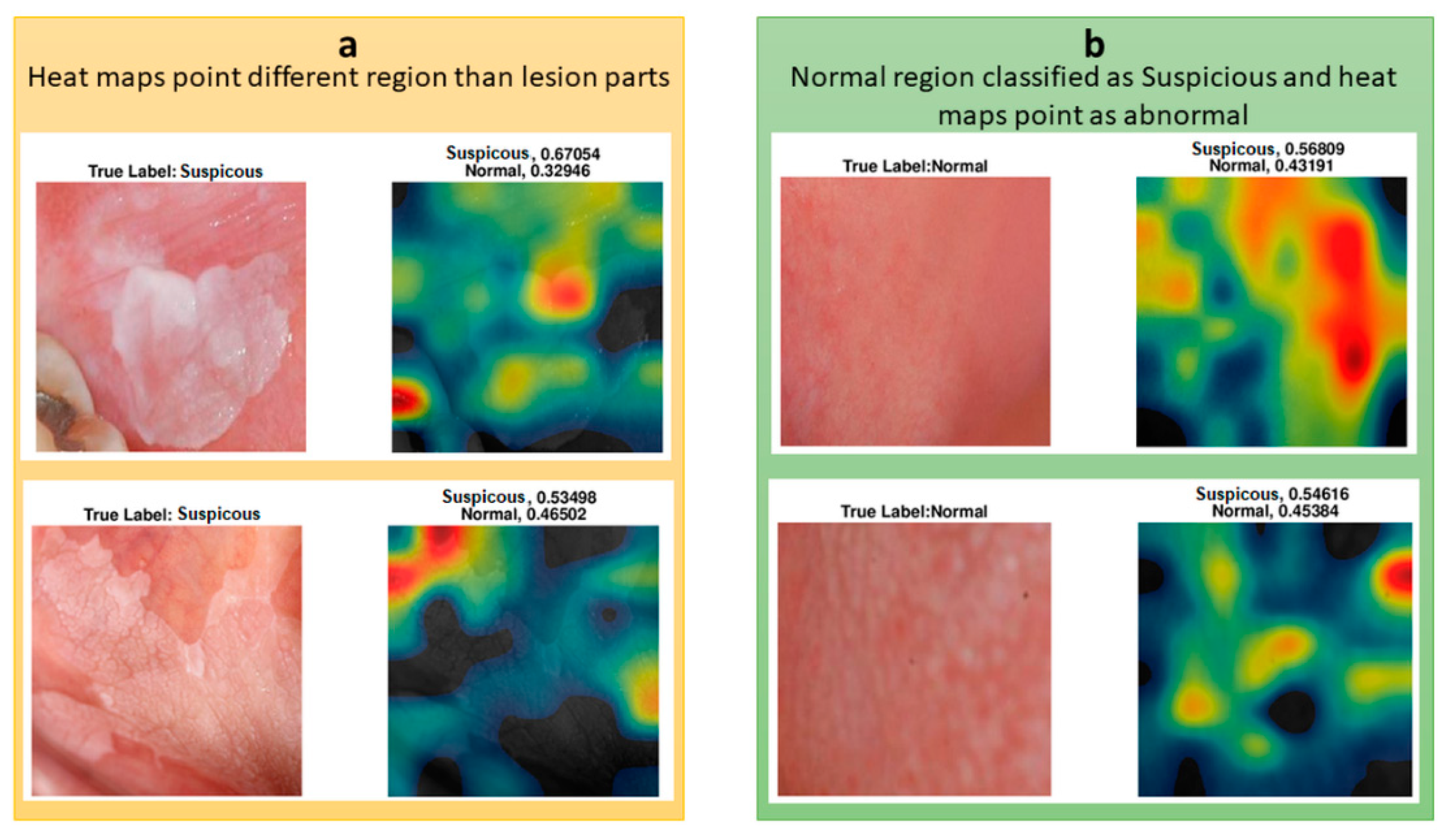 Cancers 13 01291 g008