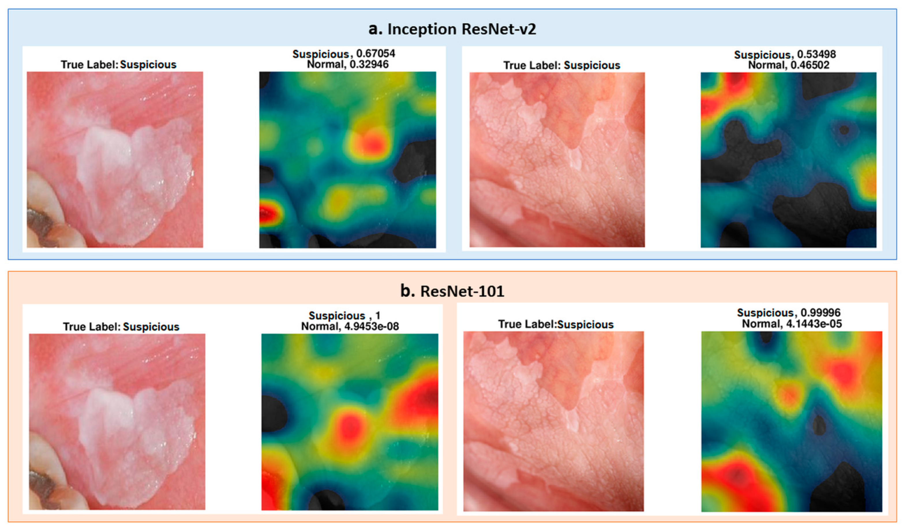 Cancers 13 01291 g009