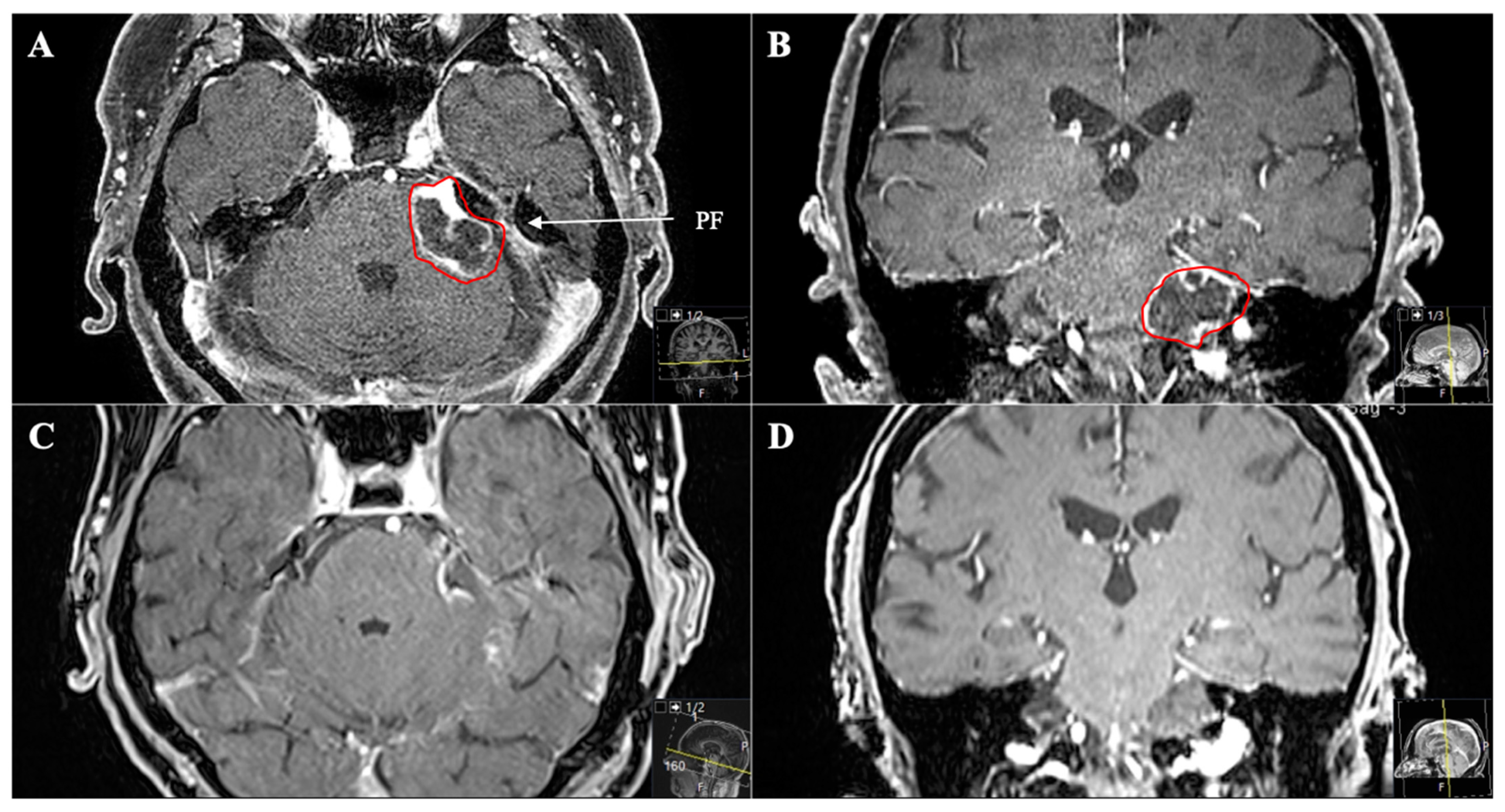 Cancers 13 01310 g006