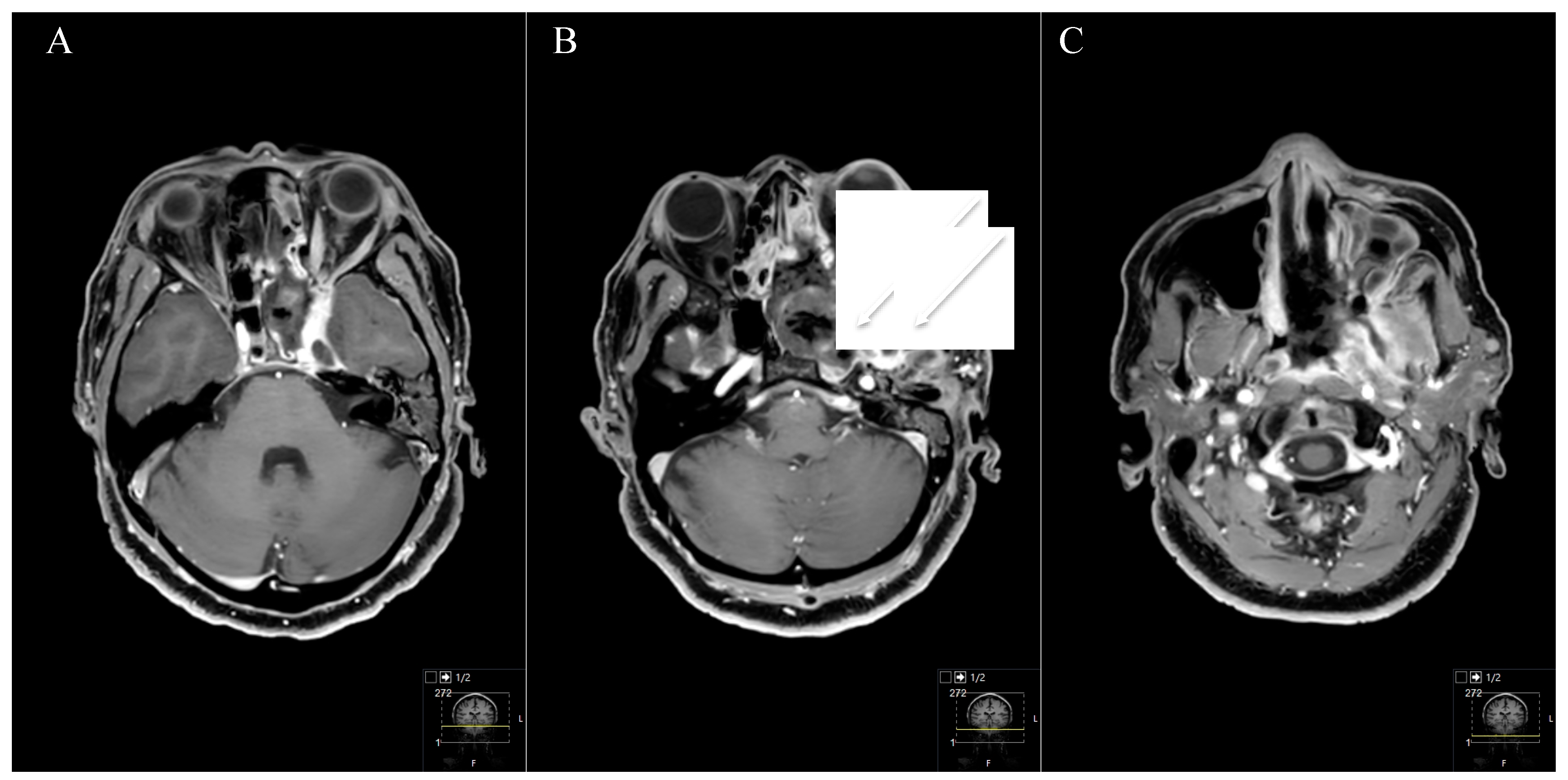 Cancers 13 01310 g010
