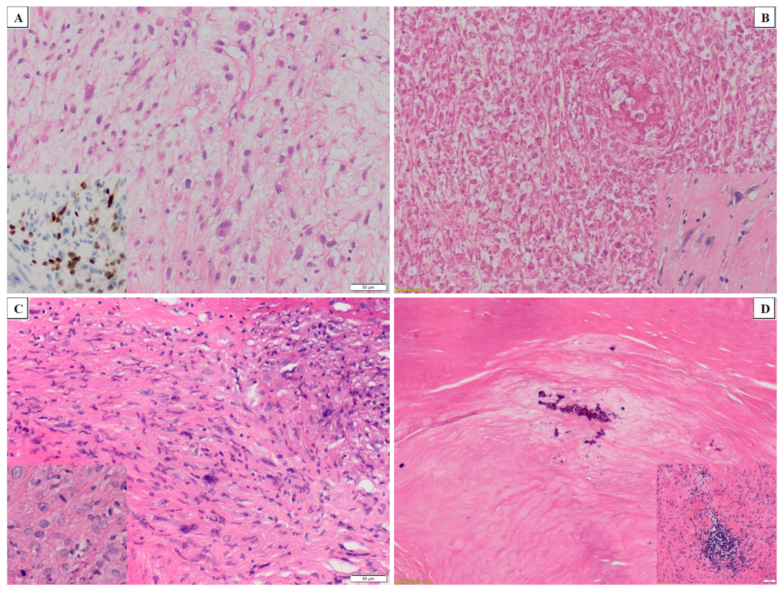 Cancers 13 01332 g002 Cancers 13 01332 g002