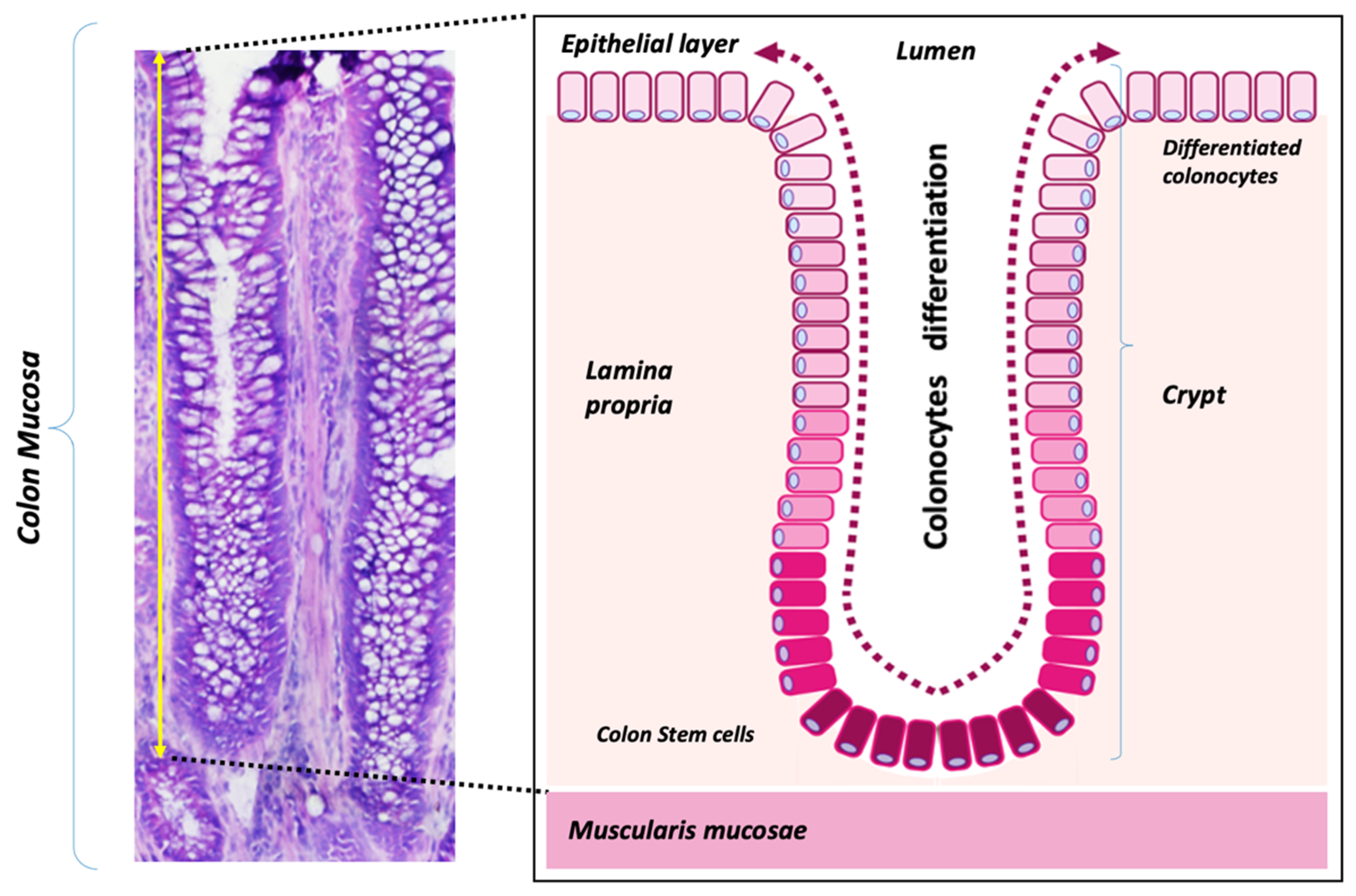 Cancers 13 01350 g001