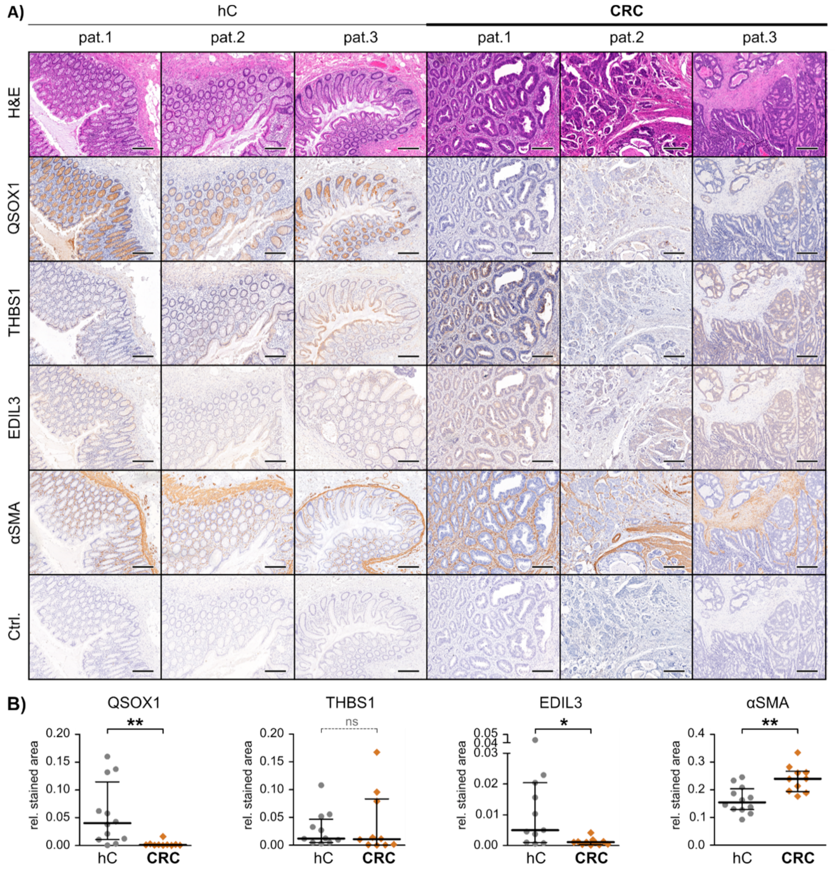 Cancers 13 01351 g003