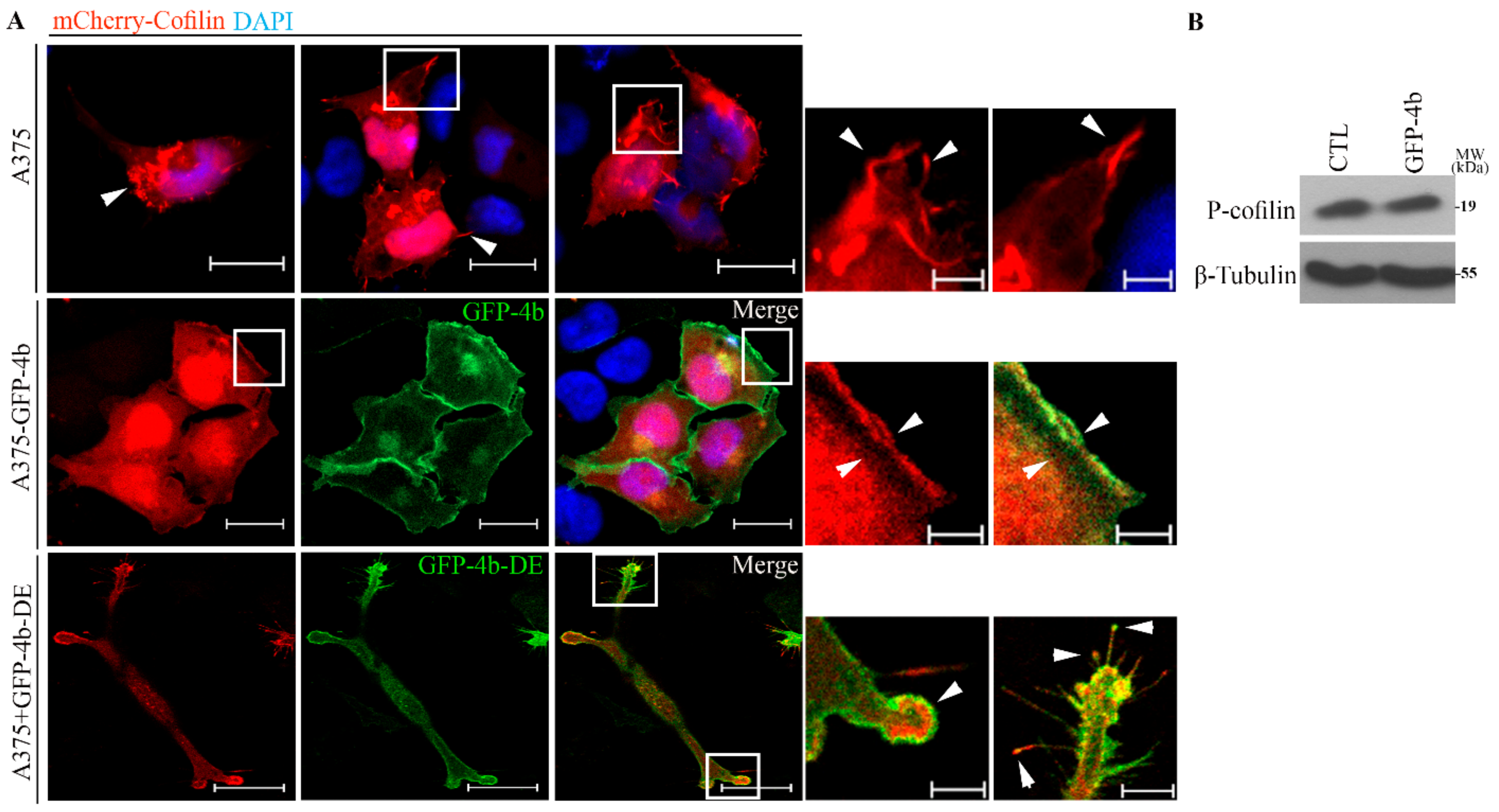 Cancers 13 01354 g009