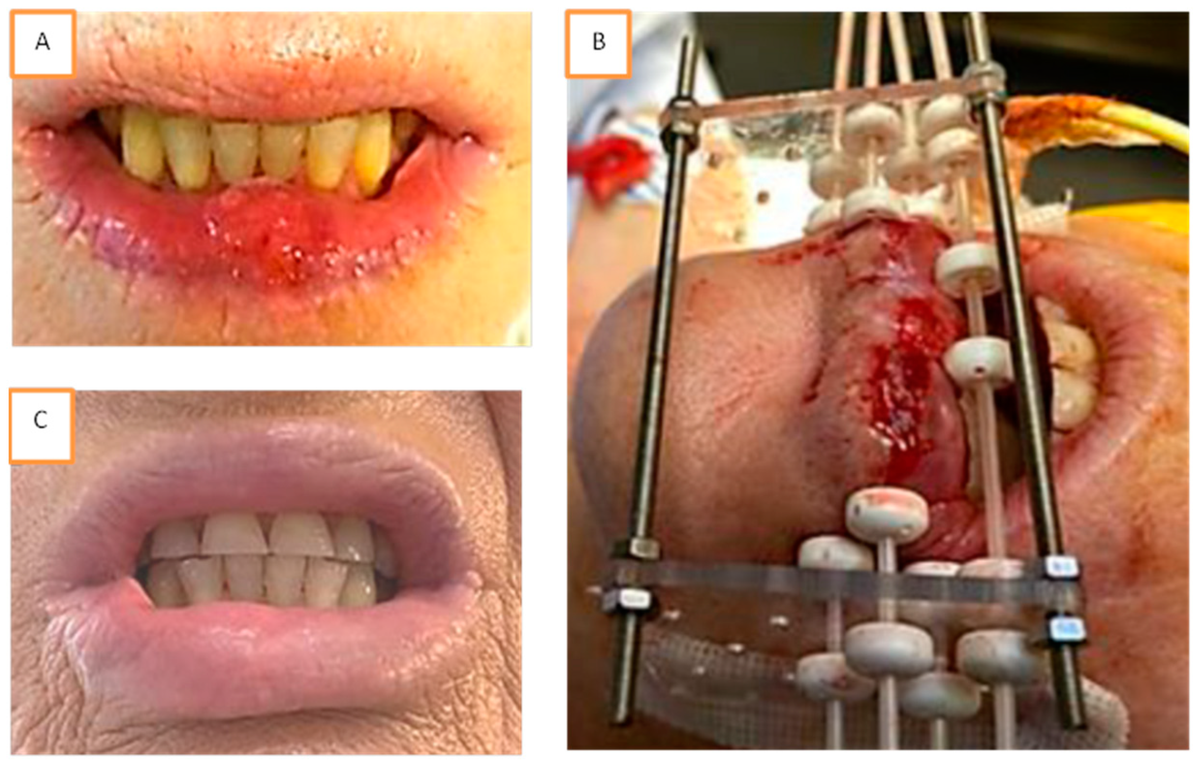 Cancers 13 01387 g001